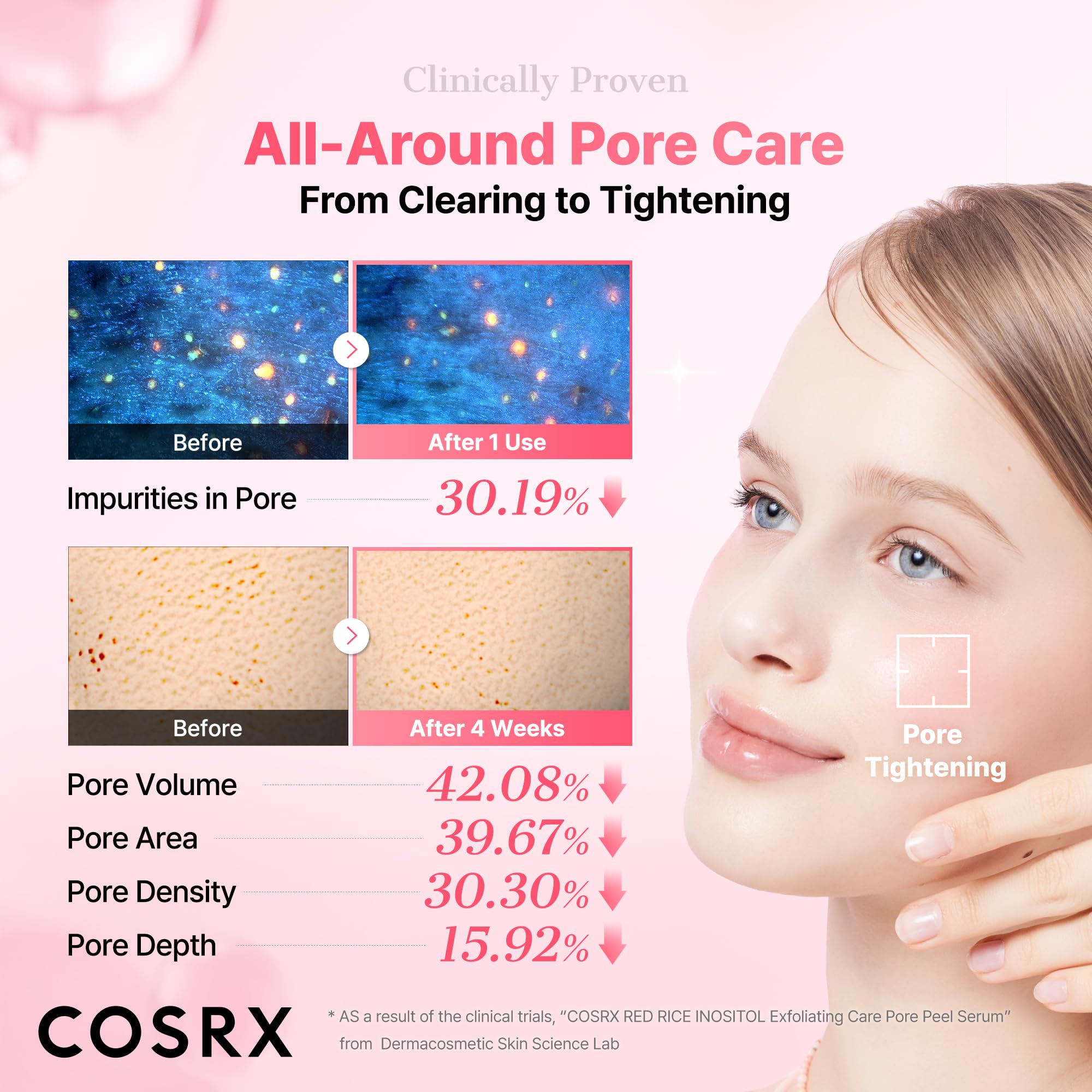 COSRX Red Rice Pore Peel Shot, Blackhead Remover AHA BHA PHA, - COSRX