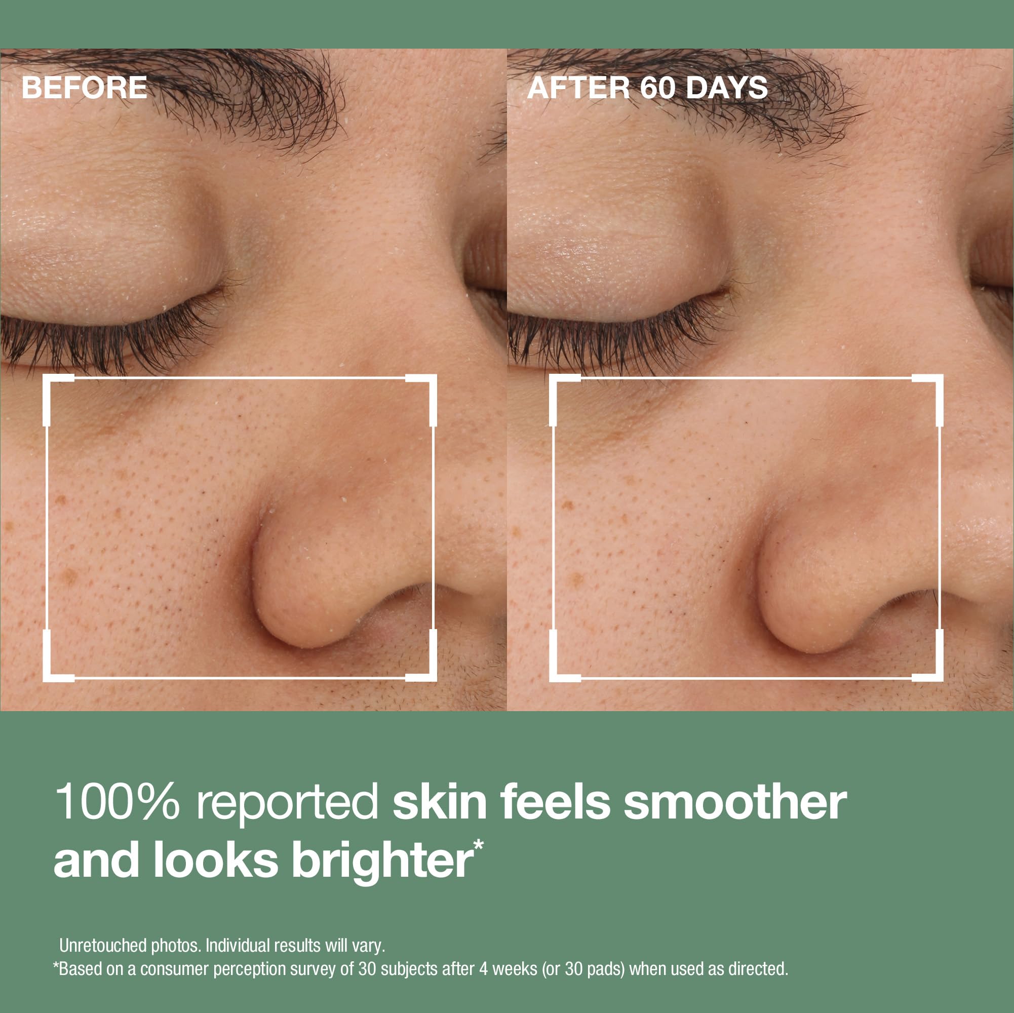 StriVectin Daily Reveal Exfoliating Face Pads 60 Count - Premium Selection Official Imagery - 5