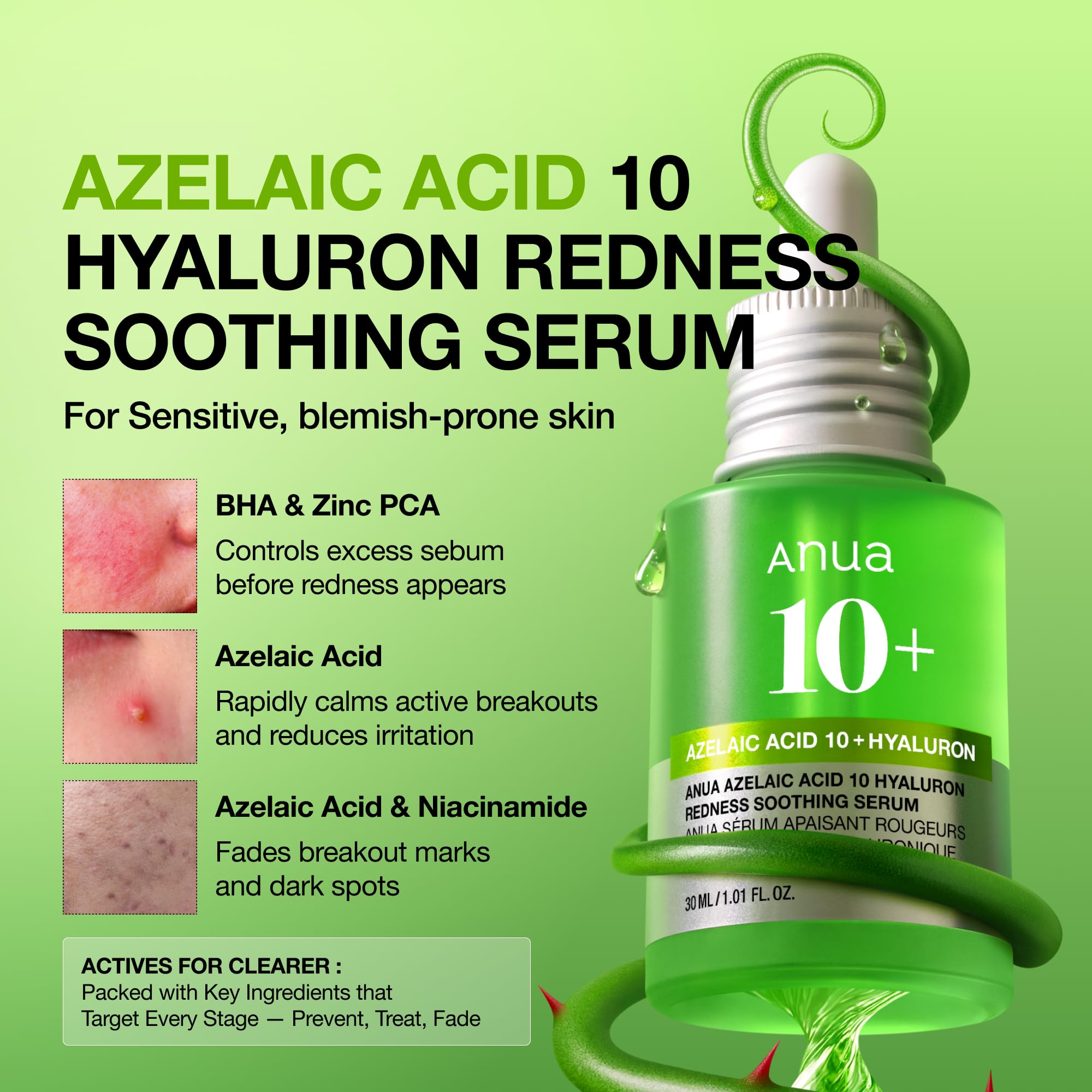Anua Azelaic Acid 10 Hyaluron Redness Soothing Serum, 1.01 fl oz - ANUA