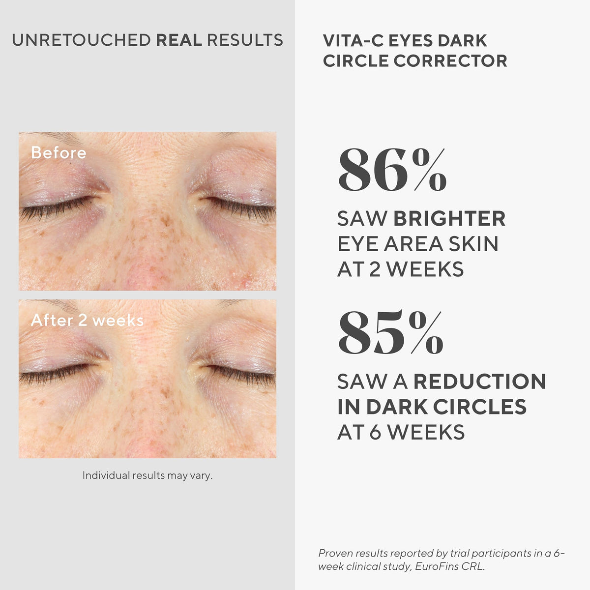 Murad Vita C Eyes Dark Circle Corrector - Premium Selection Official Imagery - 4