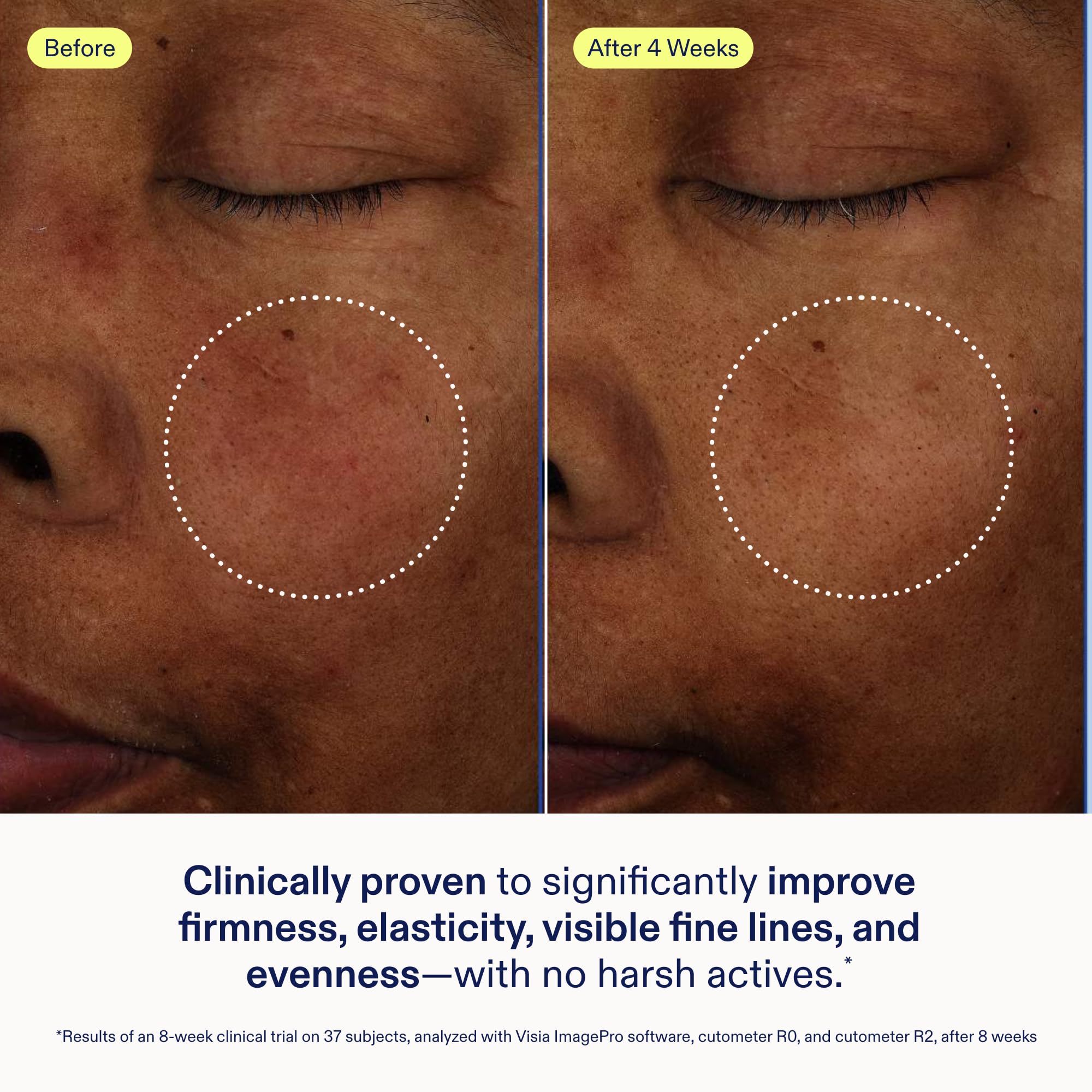 Skinfix Exo Ectoin Intensive Repair Baume - Skinfix Official Imagery - 6
