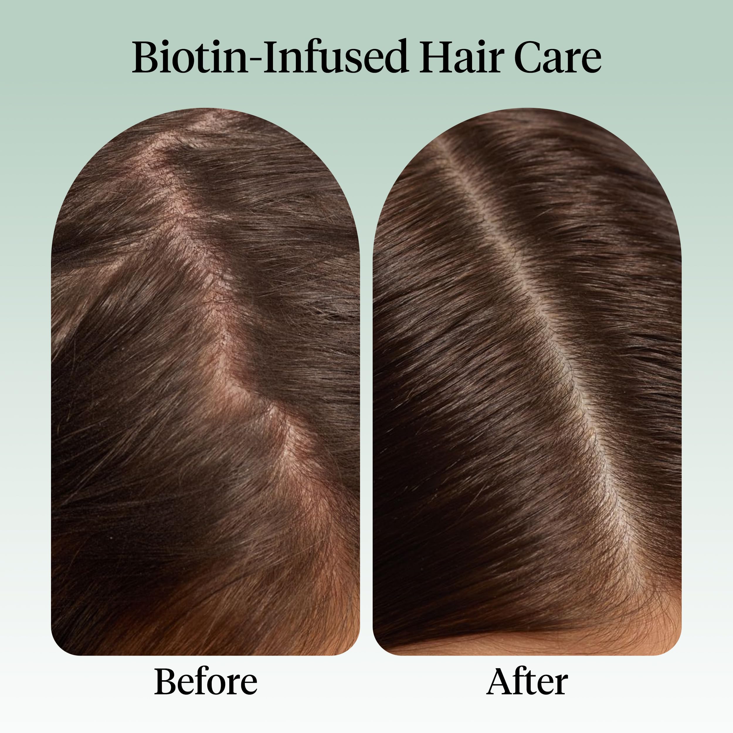 Elefair Tech Kitsch Rosemary Oil for Hair Growth - With Castor Oil & Biotin & Jojoba - Elefair Tech Official Product View 5