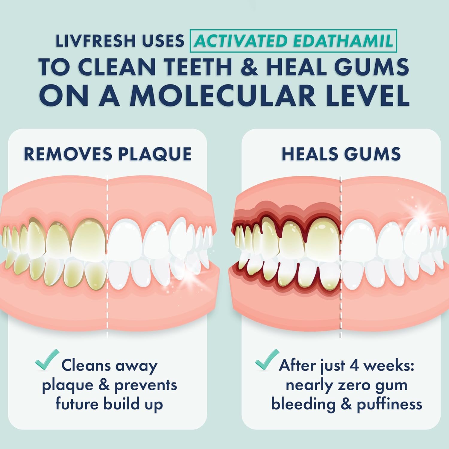 LIVFRESH Toothpaste Gel 81g, clinically proven to remove plaque and improve gum health, displayed in a tube.