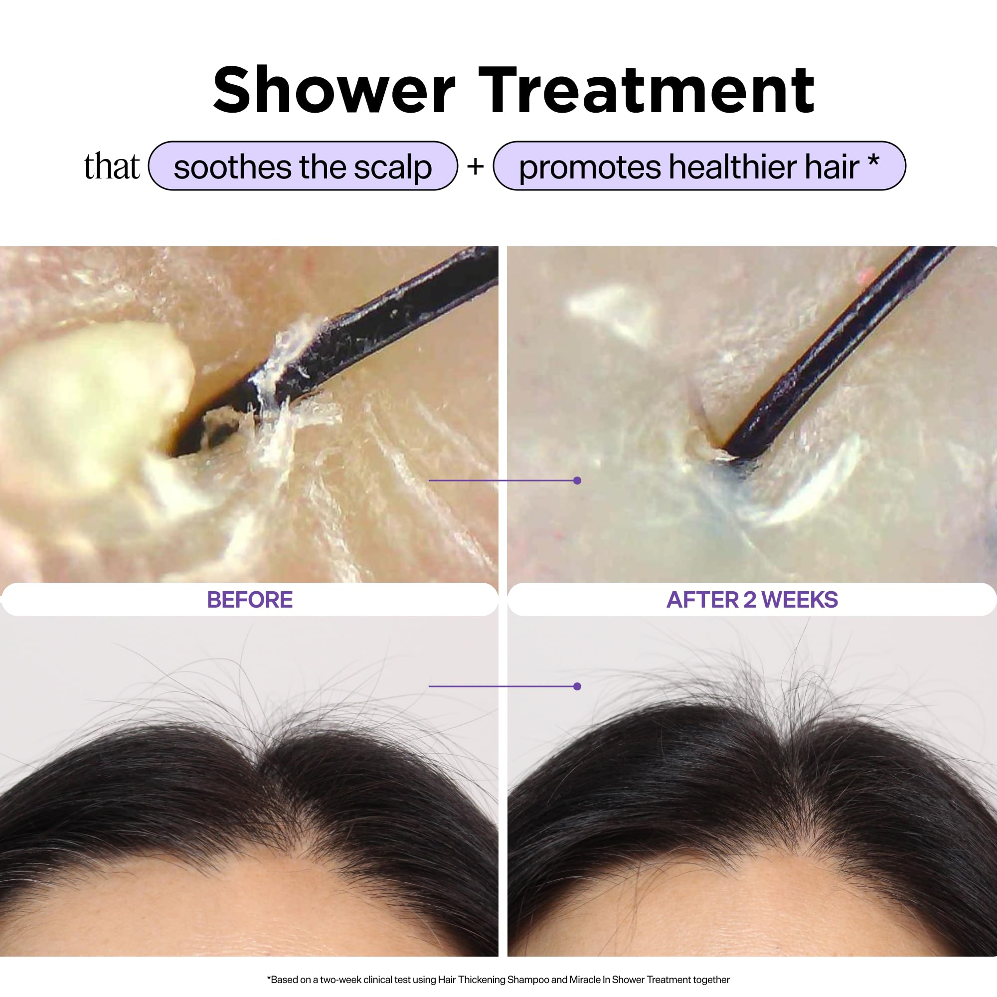 Dr. Groot Miracle in Shower Moisturizing Treatment for Hair Loss, Korean Hair - Dr. Groot Official Product View 3