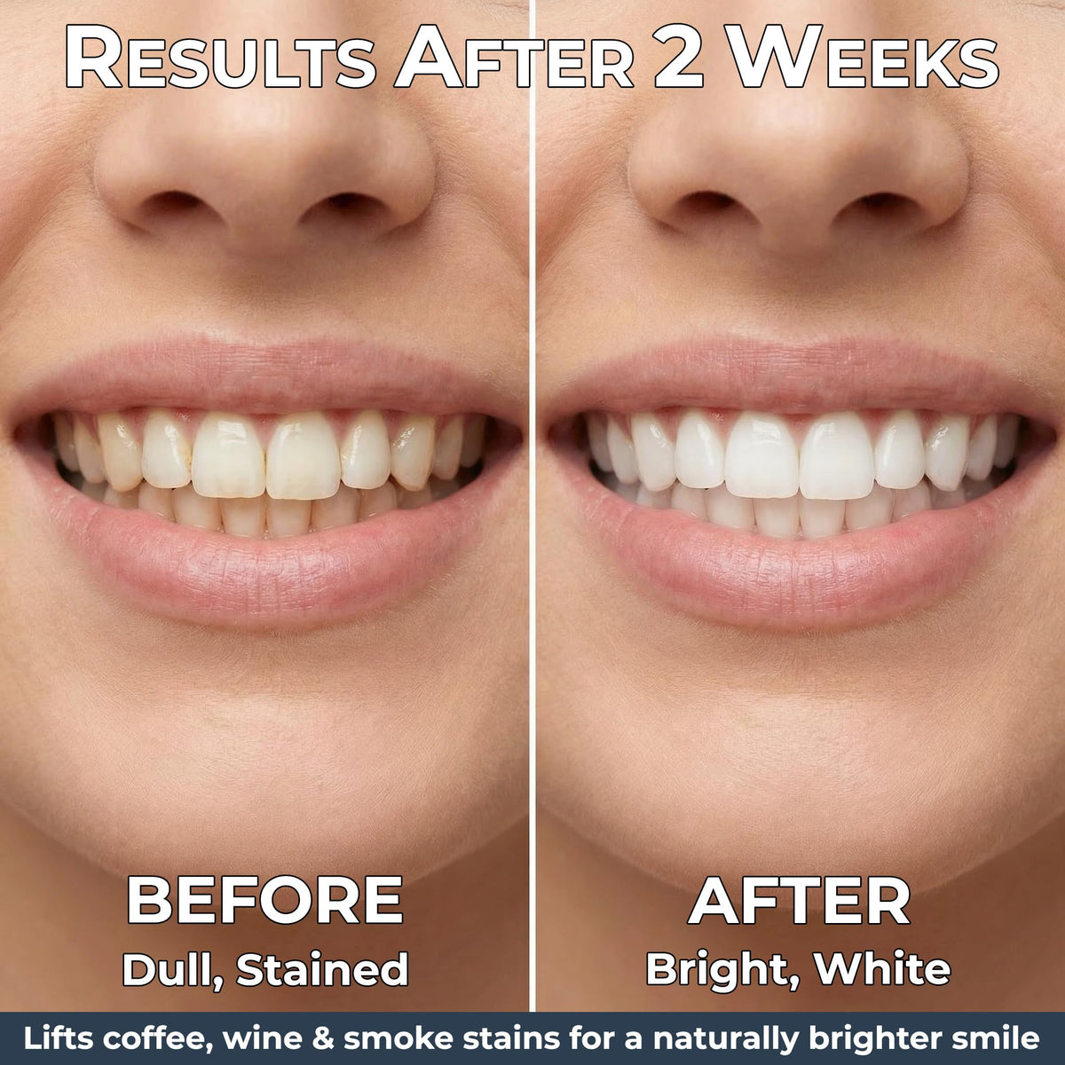 Teeth Whitening Strips for Sensitive Teeth 7 Treatments 14 - Cuteeth Official Imagery - 3