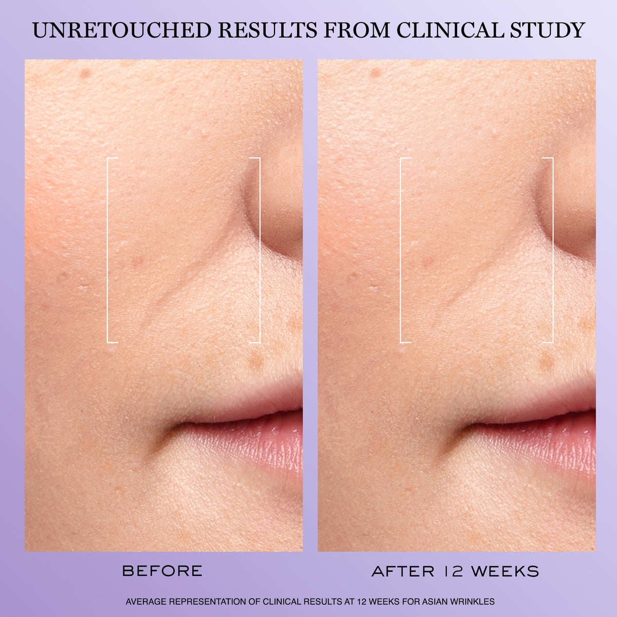 Lanc me R nergie H C F Triple Serum - Premium Selection Official Imagery - 4