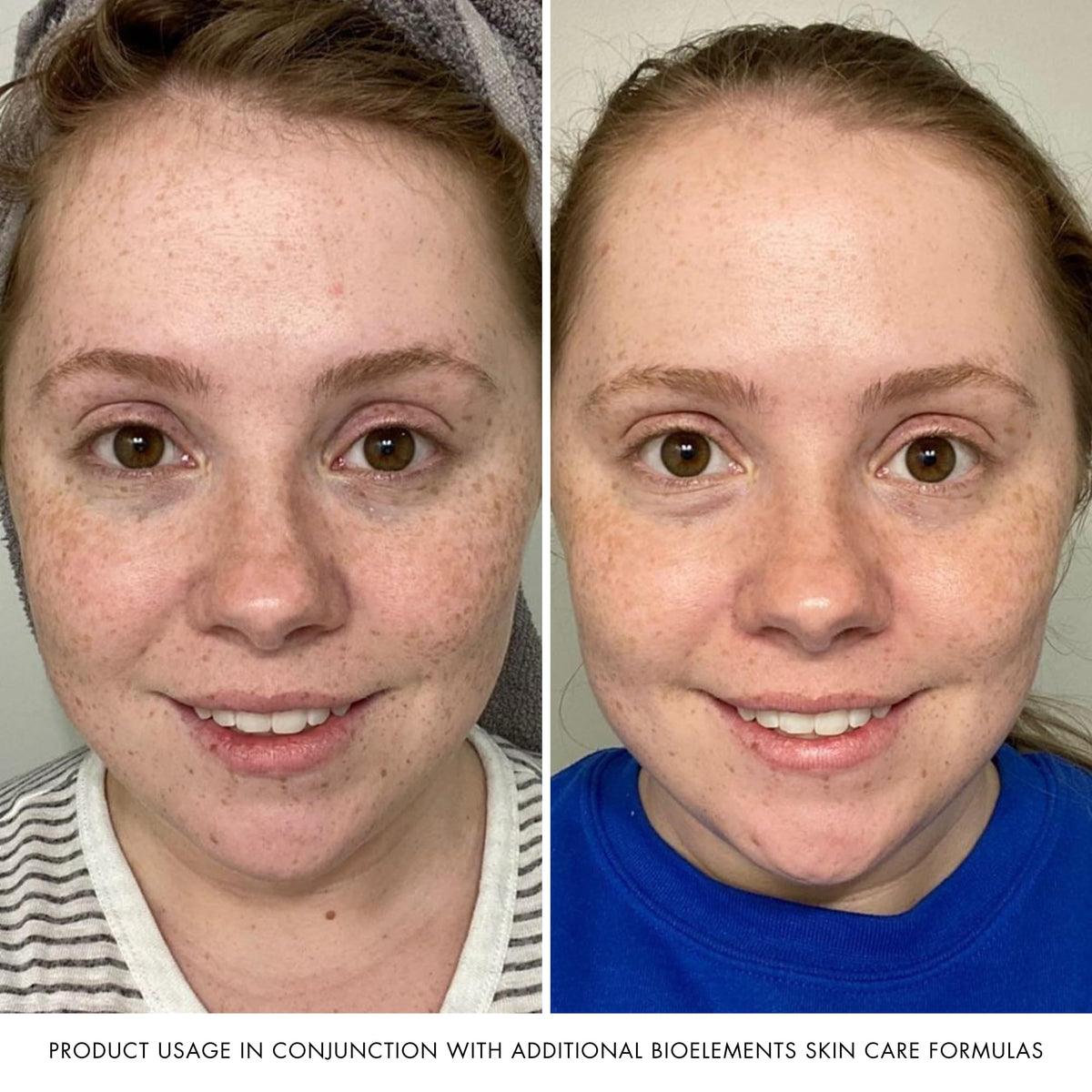 Bioelements Decongestant Cleanser - Premium Selection Official Imagery - 6
