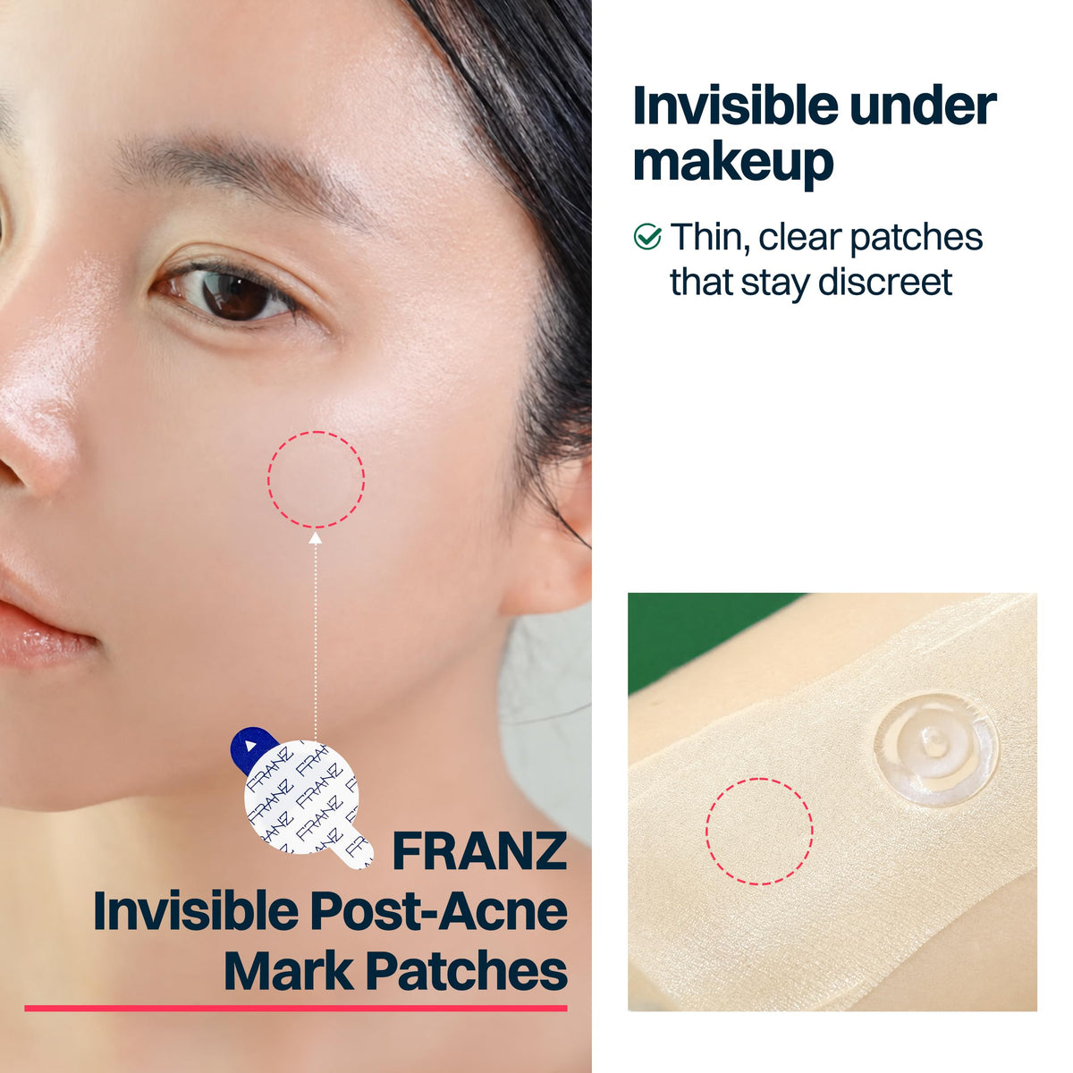 FRANZ Invisible Post Acne Mark Patches Tone Care Dots - FRANZ Official Product Imagery - 6