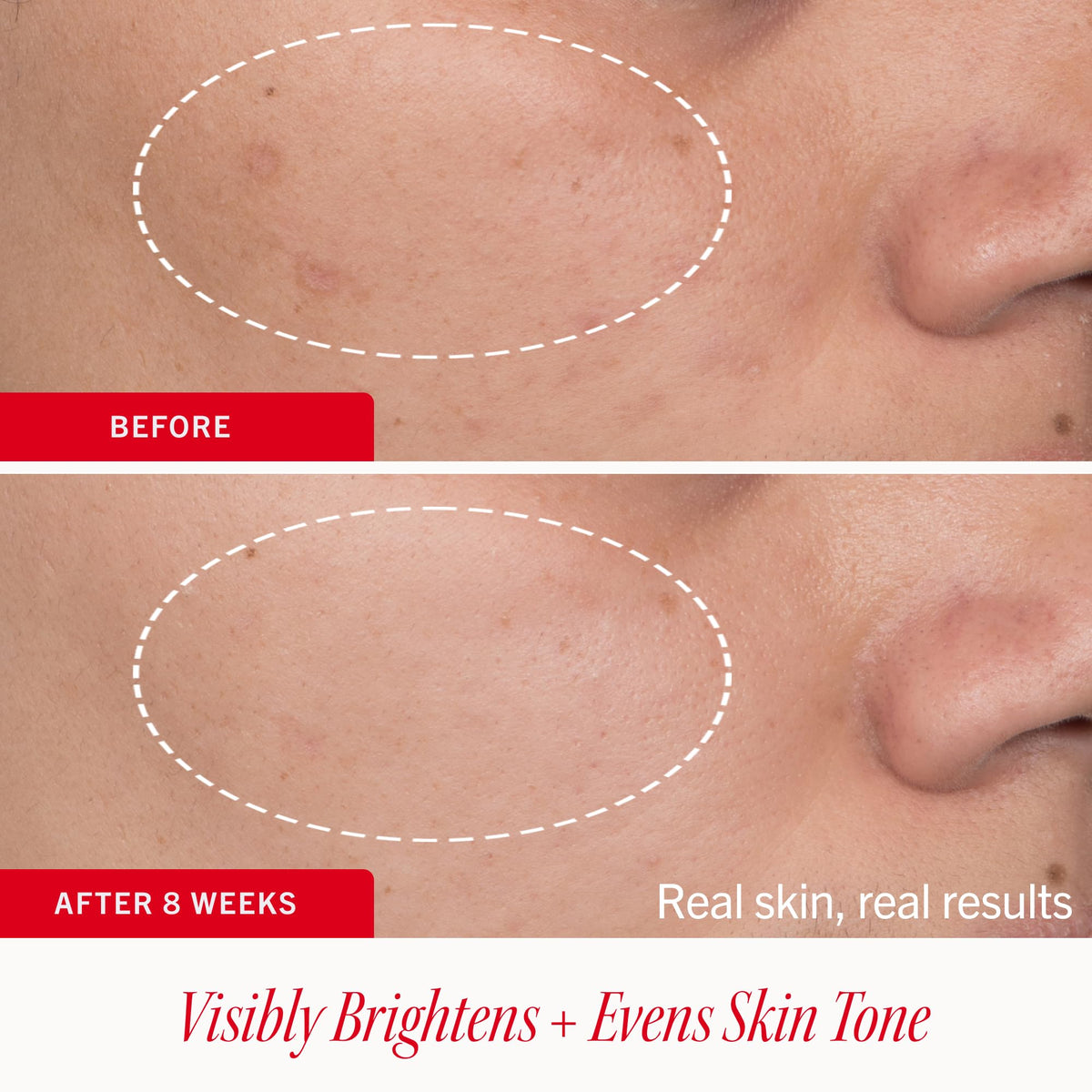 First Aid Beauty Brighten Glow Dark Spot Serum with - Premium Selection Official Imagery - 5