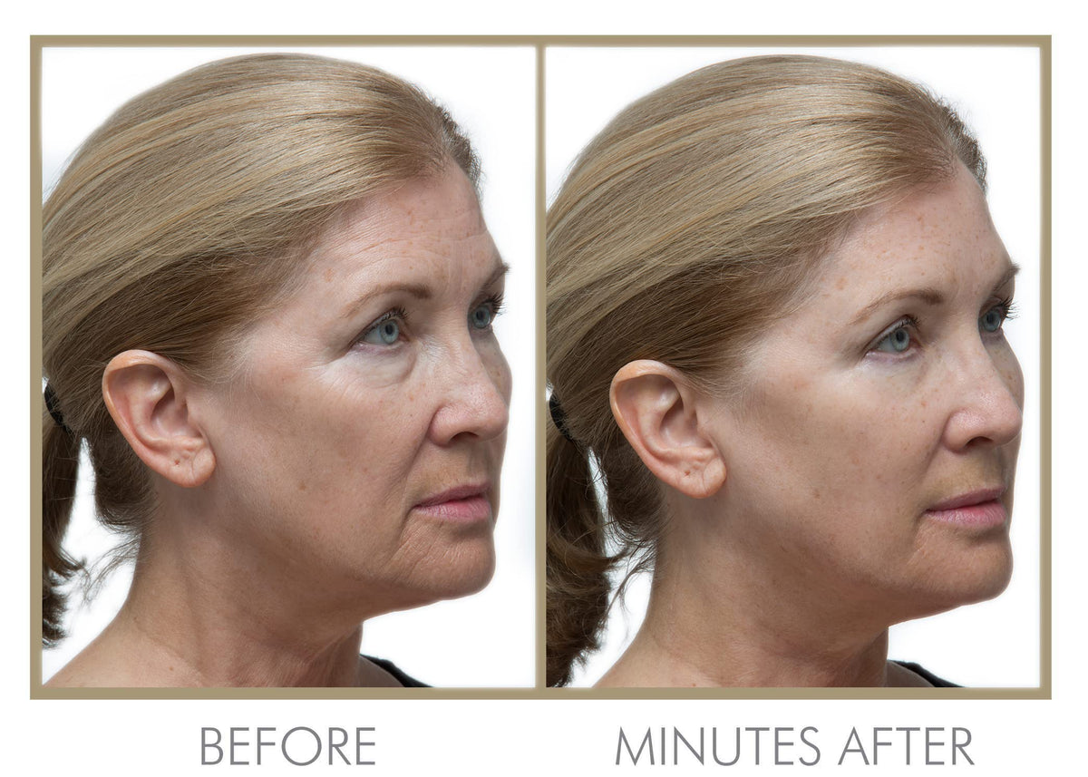 GENIE Instant Line Smoother - GENIE Official Imagery - 7