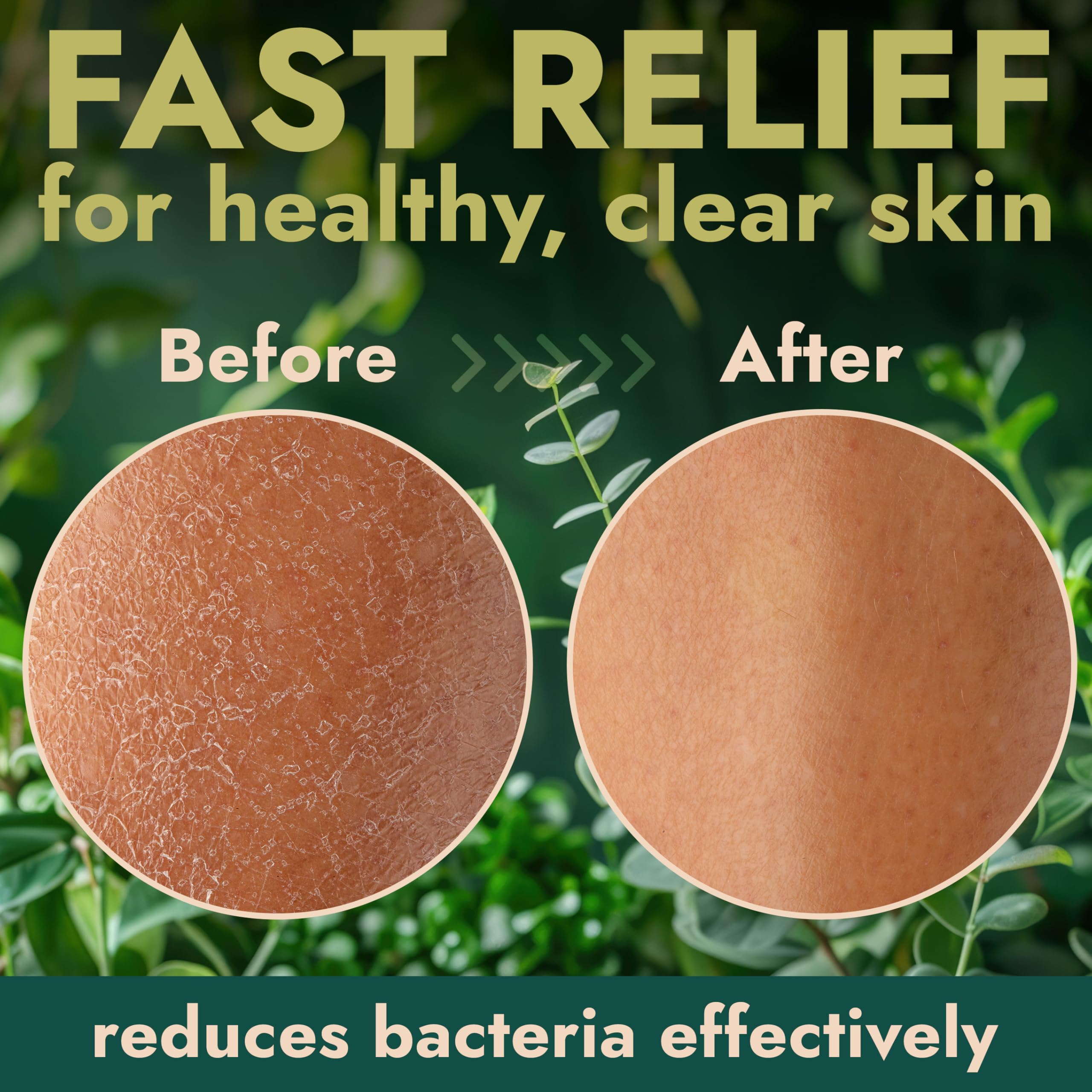 Antibacterial Body Wash | Back Acne & Odor Relief 16 oz