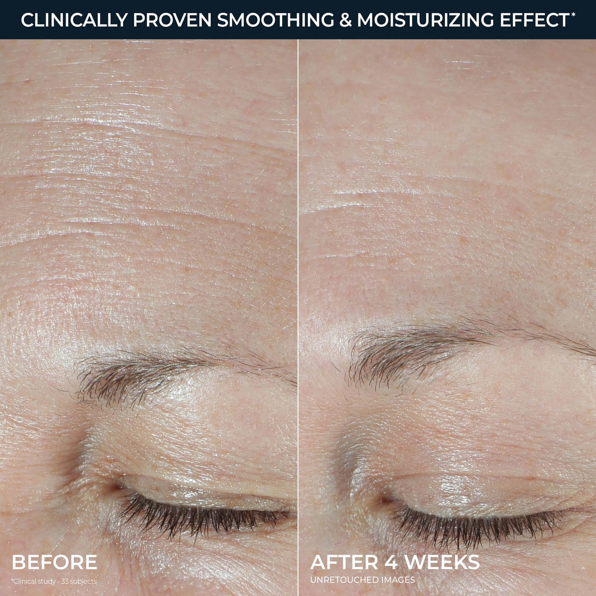 RoC Hydration Hyaluronic Acid Moisturizer Face Cream - RoC Official Imagery - 5
