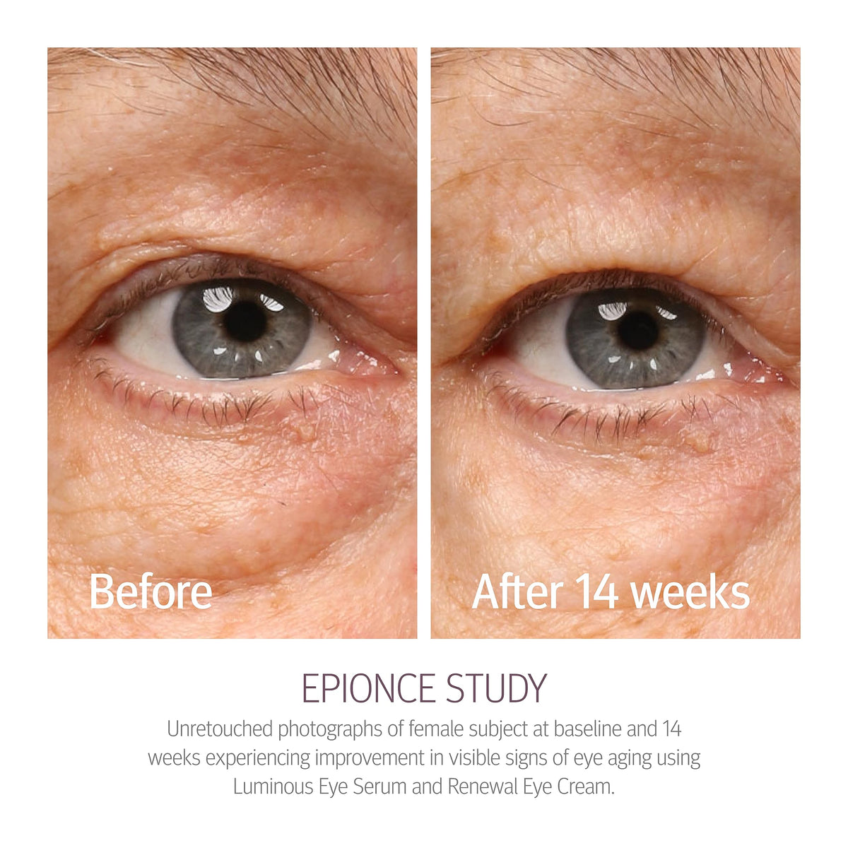 Epionce Renewal Eye Cream Anti Aging Under Eye Cream Dark - Premium Selection Official Imagery - 5