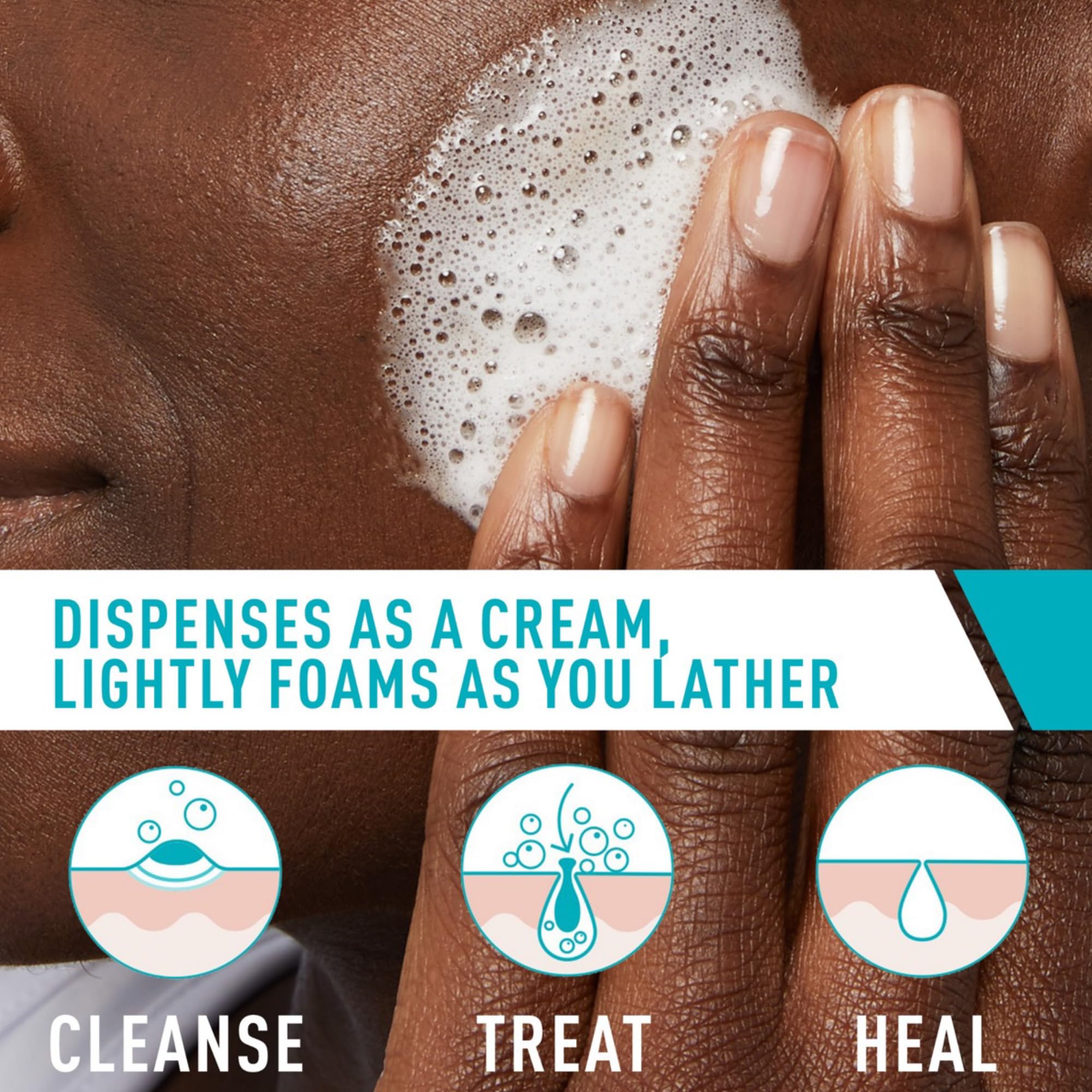 CeraVe Foaming Acne Cream Cleanser, Face Wash with 4% Benzoyl Peroxide - CeraVe Official Product View 4