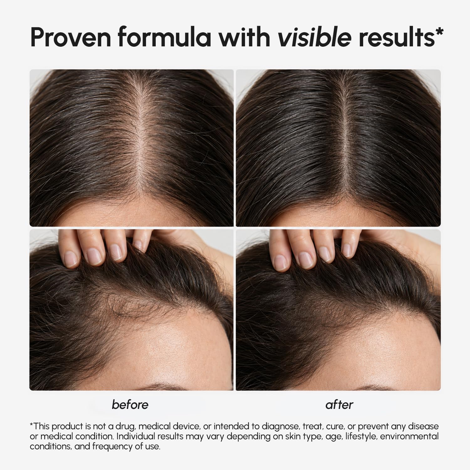 MAREE Hair Growth Serum - Caffeine Peptides Castor Rosemary Oil - MAREE Official Product View 10