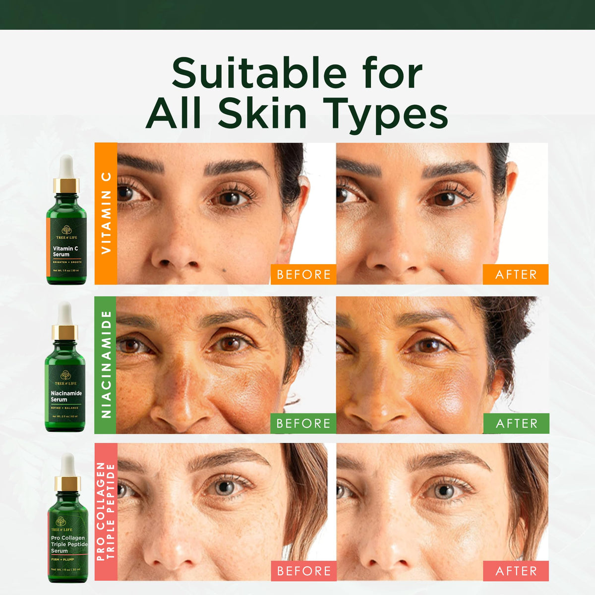 Tree of Life Face Serum Skin Care Set Vit C Niacinamide - Tree of Life Official Imagery - 4