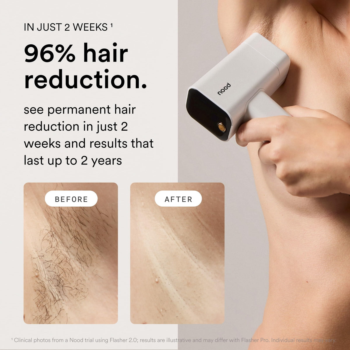 Nood Flasher Pro - Nood Official Imagery - 4
