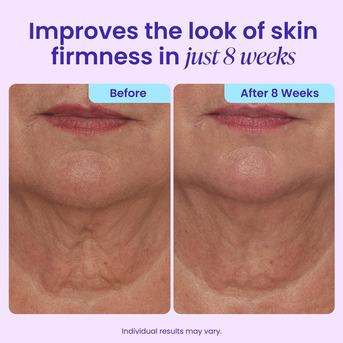 goPure Tighten Lift Neck Chest Moisturizer Cream for Visibly - goPure Official Imagery - 3