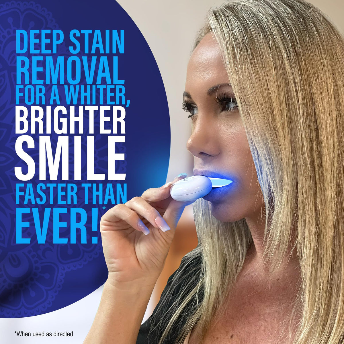 GuruNanda Professional Teeth Whitening Wireless Kit with LED - GuruNanda Official Imagery - 2