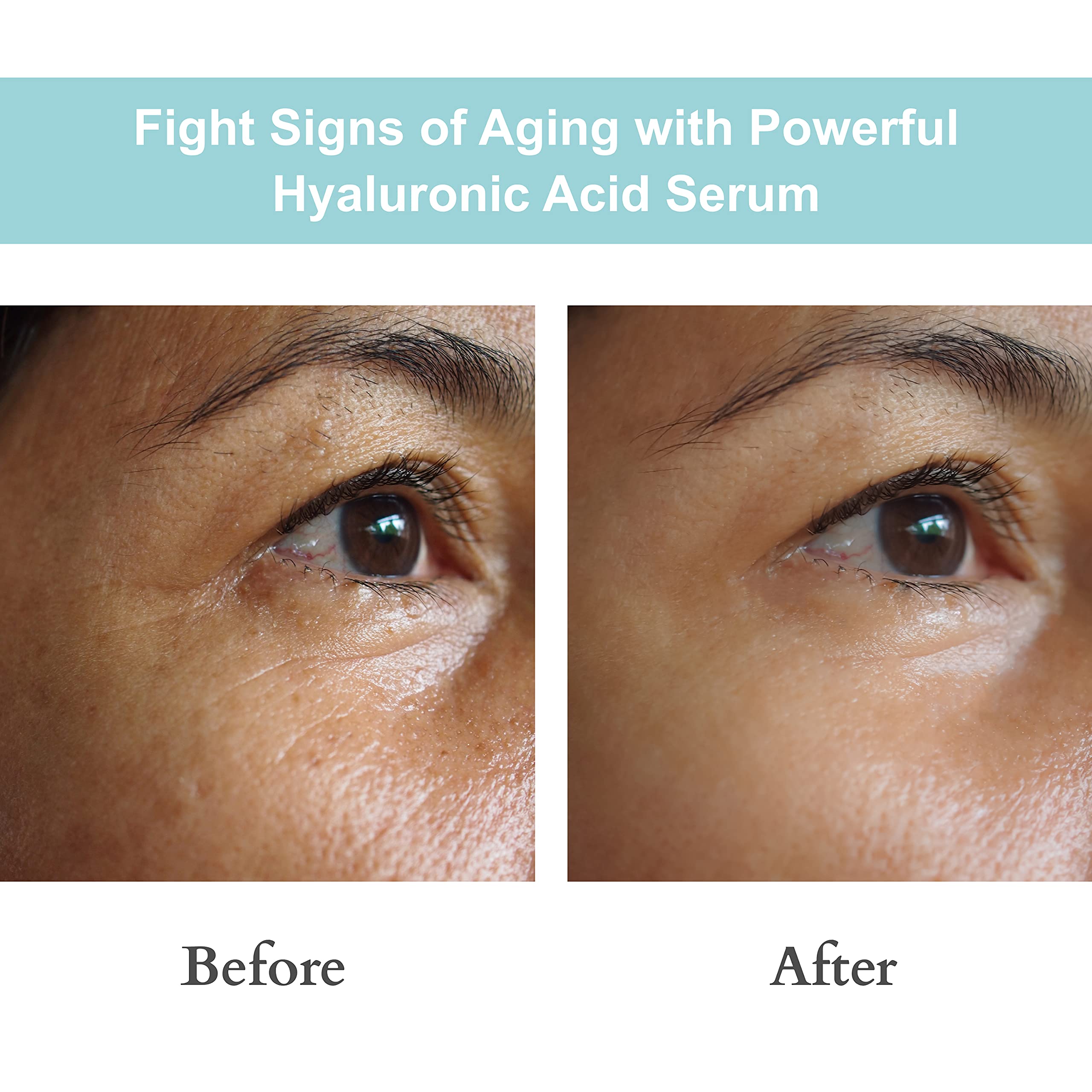 JOYAL BEAUTY Hyaluronic Acid Serum for Face Lips Eyes. 100% Pure - JOYAL BEAUTY