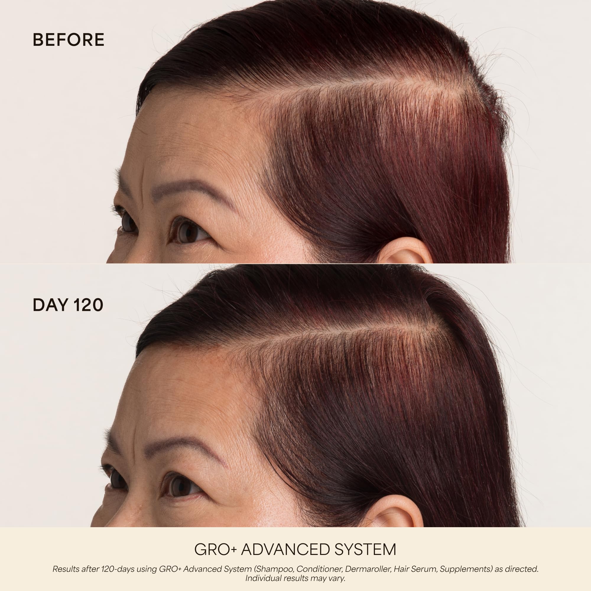 VEGAMOUR Scalp Dermaroller - Premium Selection Official Imagery - 4
