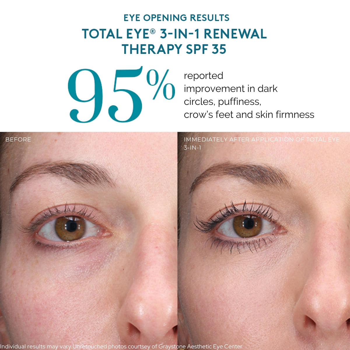 Colorescience Total Eye 3 in 1 Renewal Therapy SPF 35 - Premium Selection Official Imagery - 7