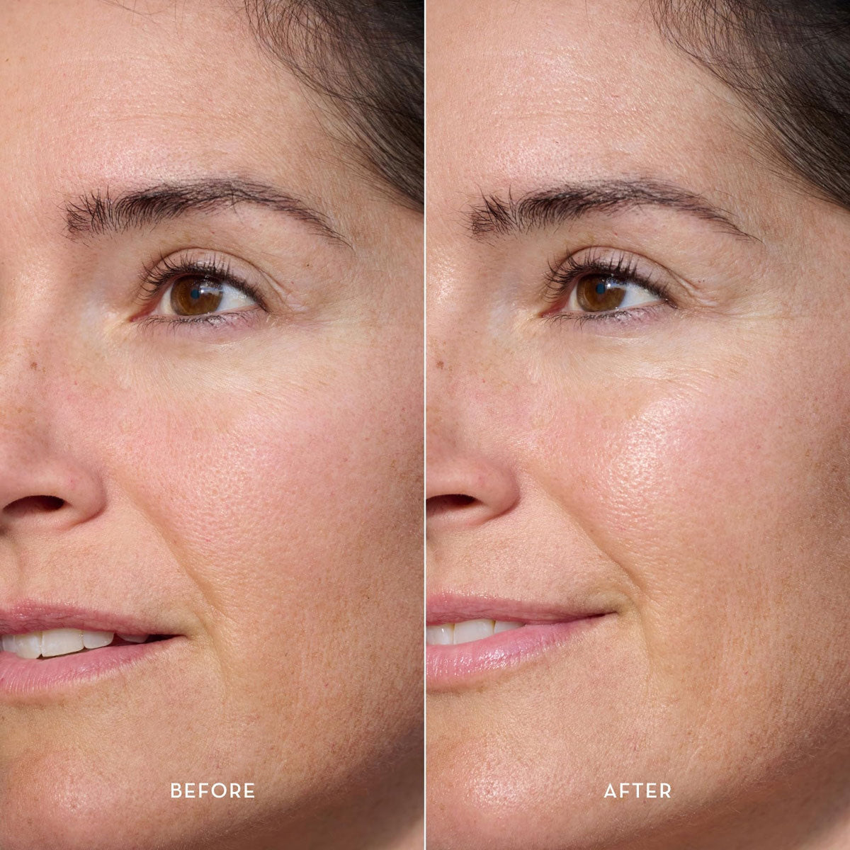 Micellar Cleansing Essence Water - Furtuna Skin Official Imagery - 4