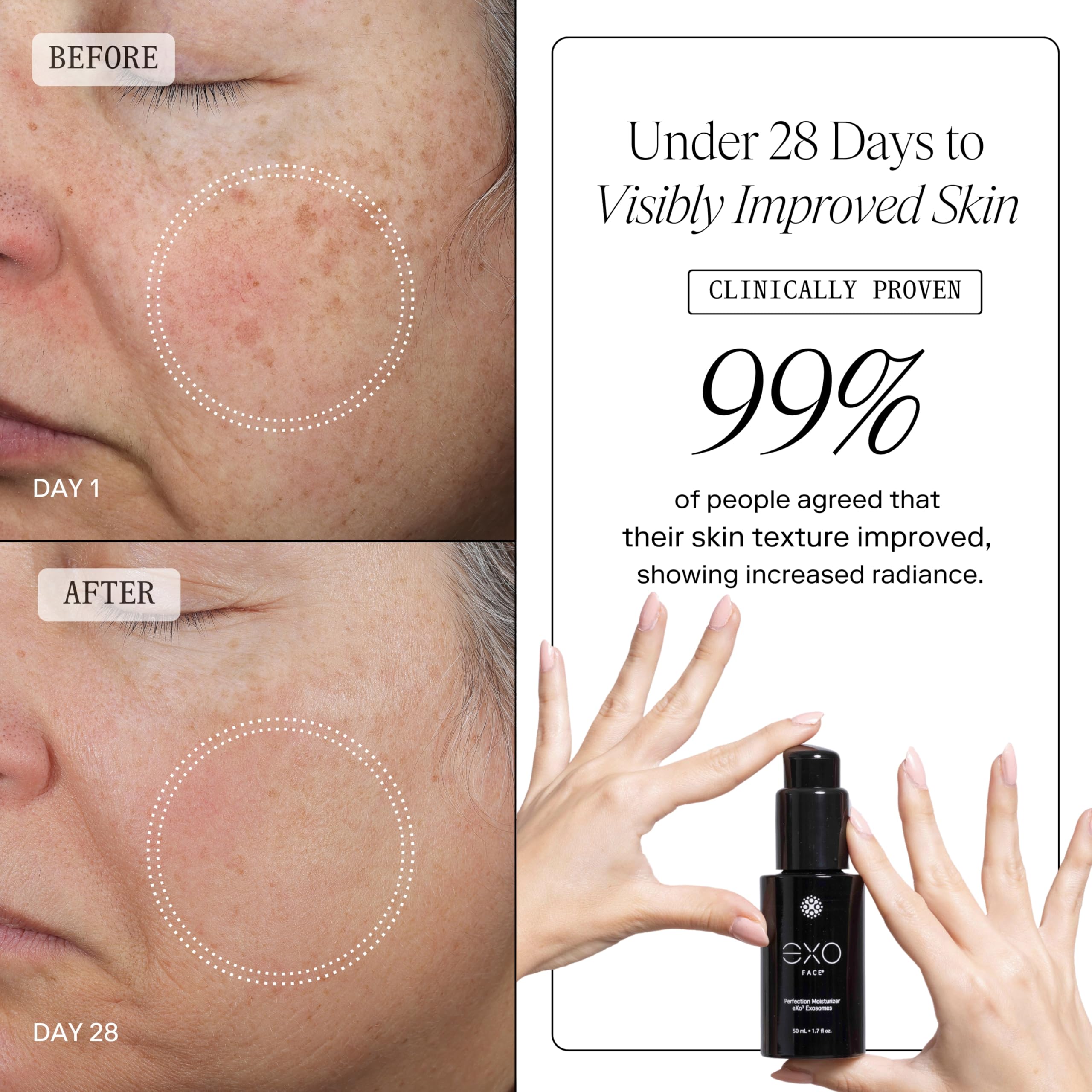 EXO FACE® - EXOCEUTICALS