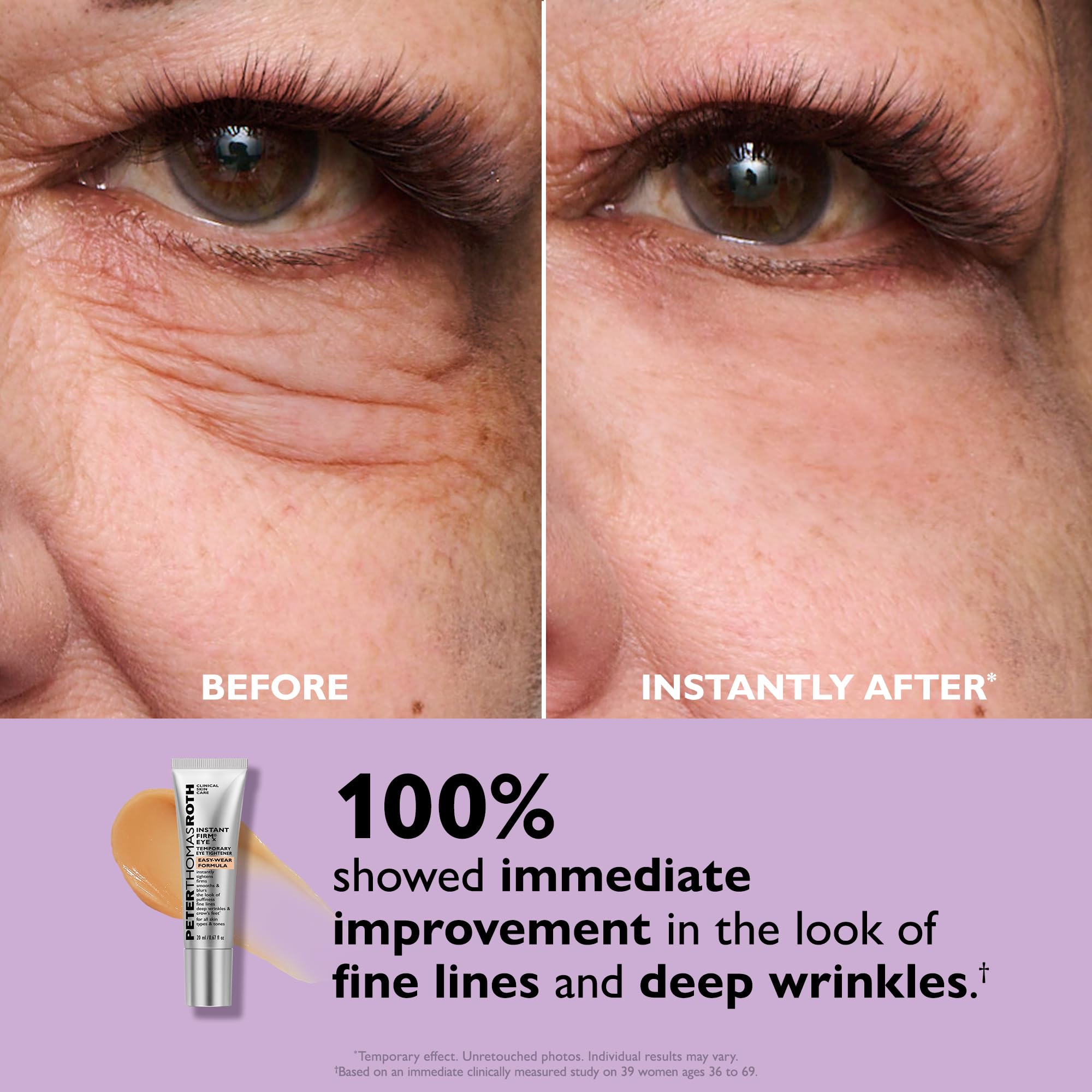 Elefair Tech Peter Thomas Roth - Instant FIRMx® Eye Temporary Eye Tight - Elefair Tech Official Product View 6