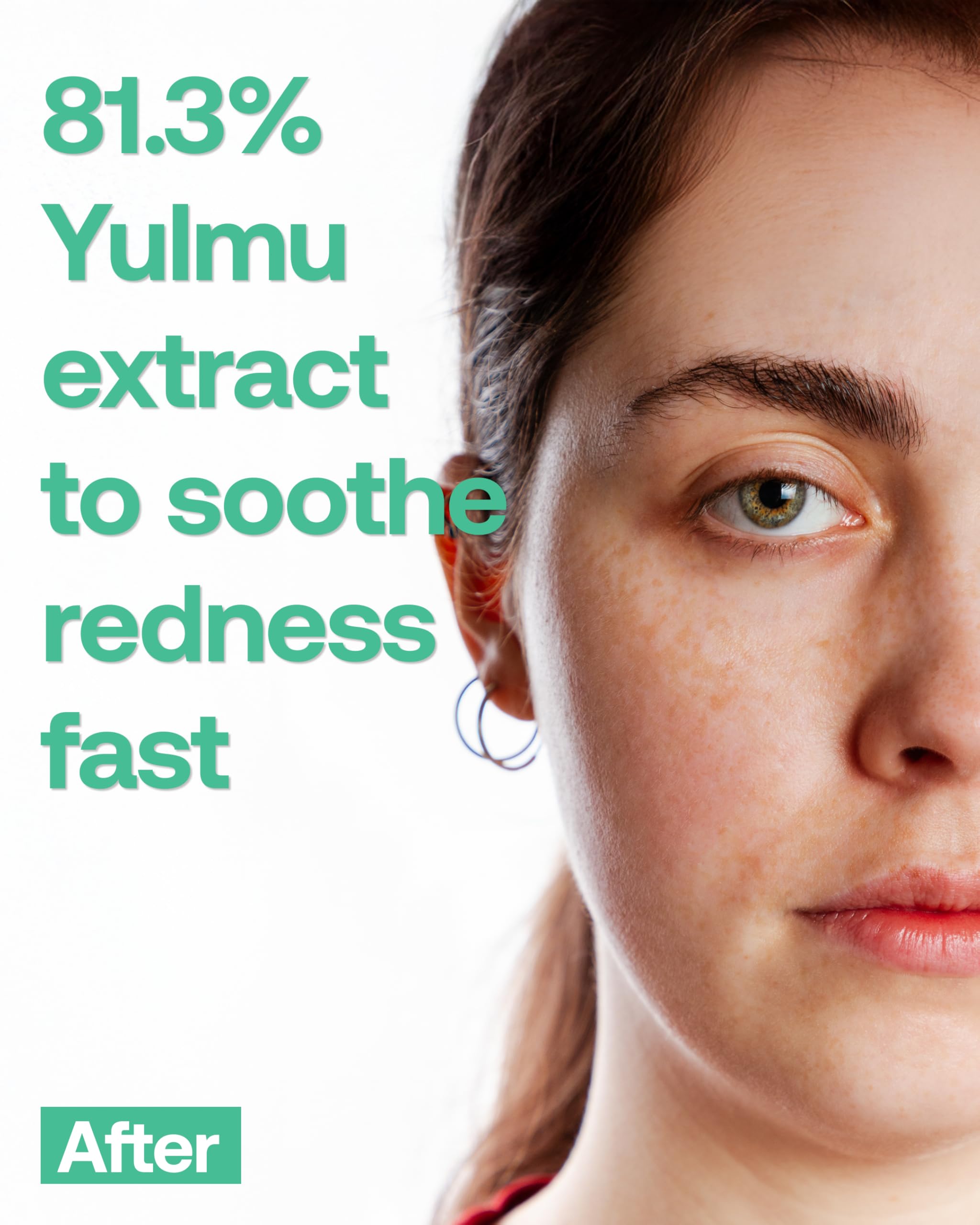 Phyto ac Infused Yulmu Trouble Serum, Korean Natural Facial - FILFLO