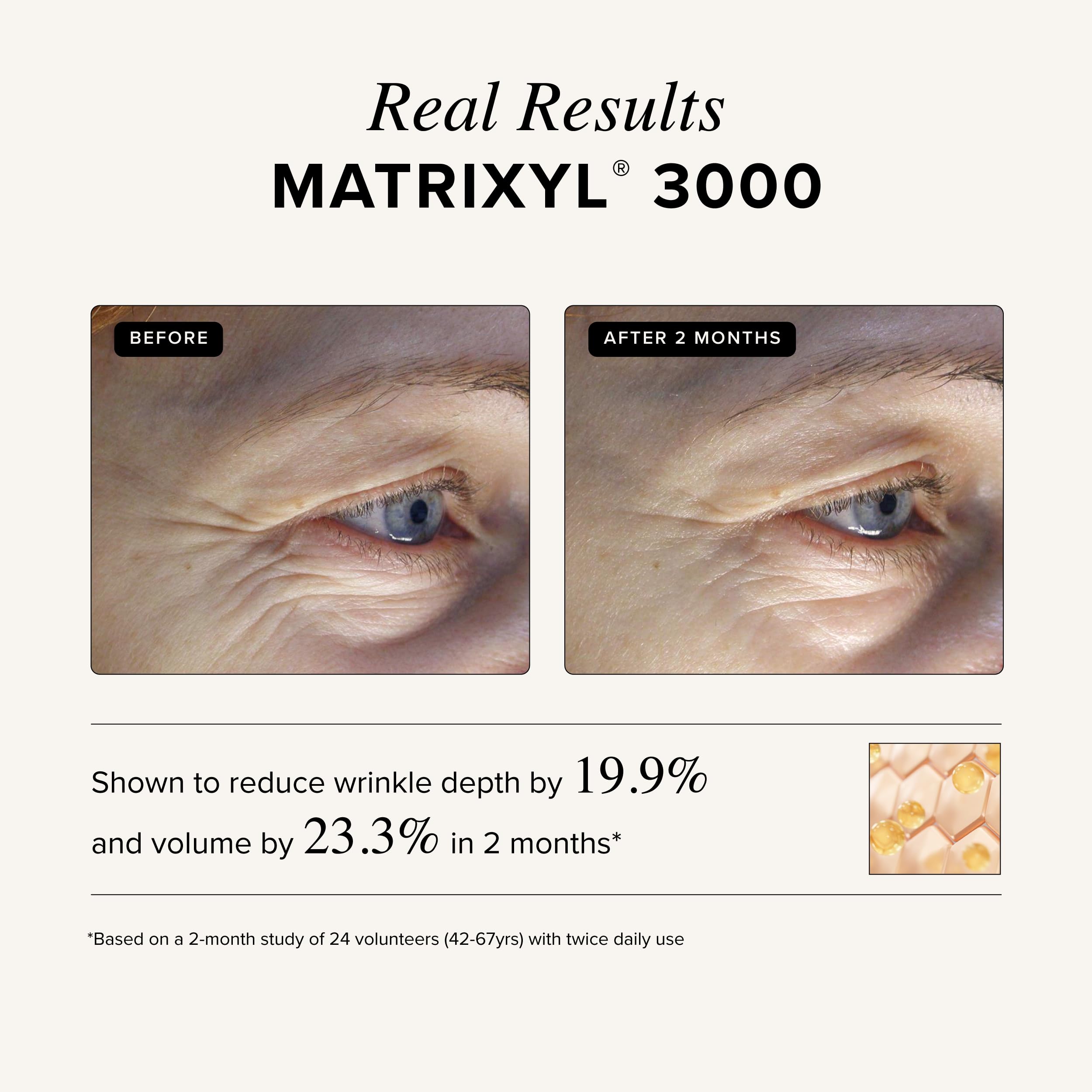 Asterwood Matrixyl 3000 & Argireline Peptide Serum with Hyaluronic Acid - Asterwood Official Product View 5