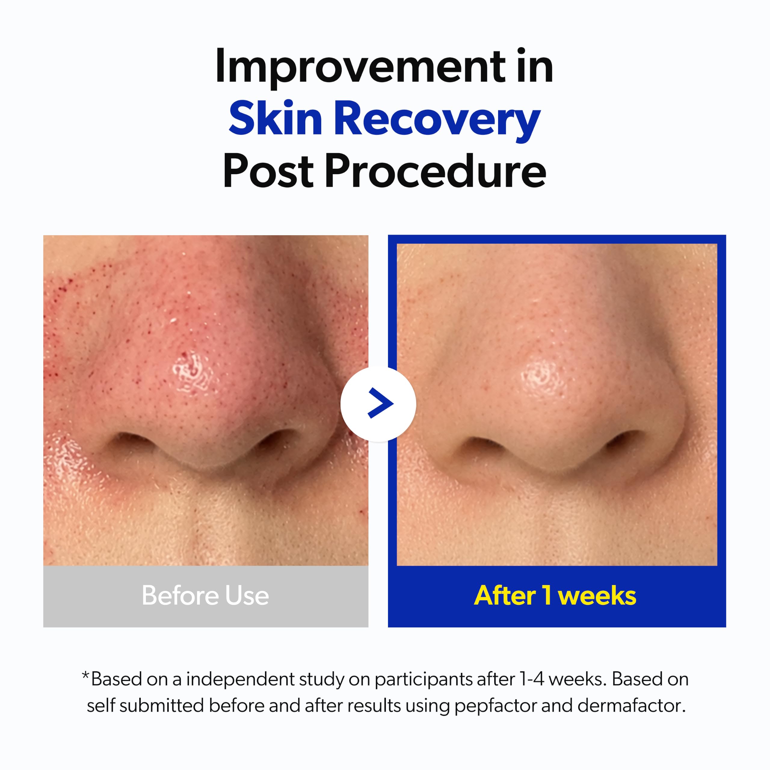 Dermafactor 30% Growth Factor Intensive Recovery Spot Care - bnv biolab