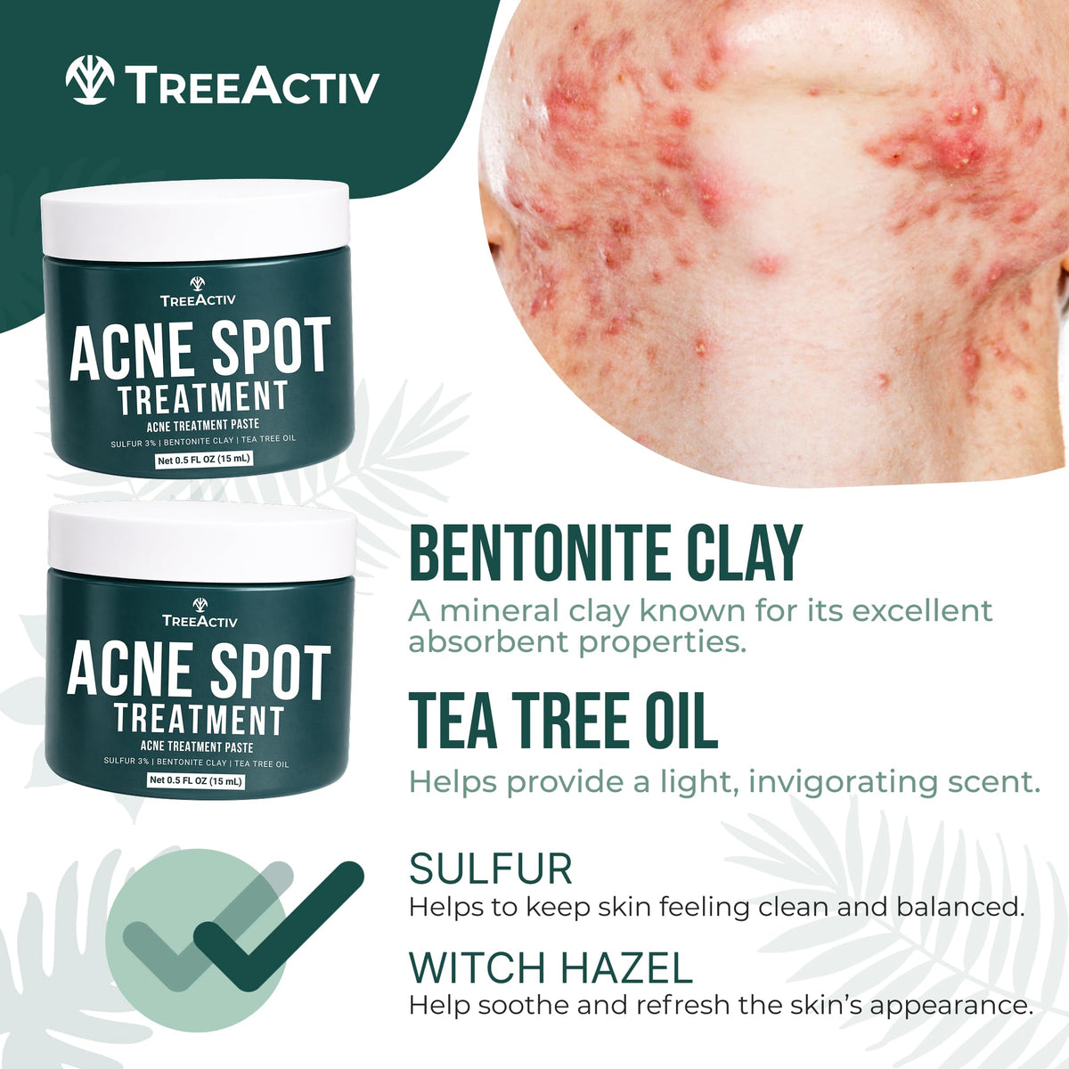 TreeActiv Cystic Acne Spot Treatment Hormonal Overnight - TreeActiv Official Imagery - 8