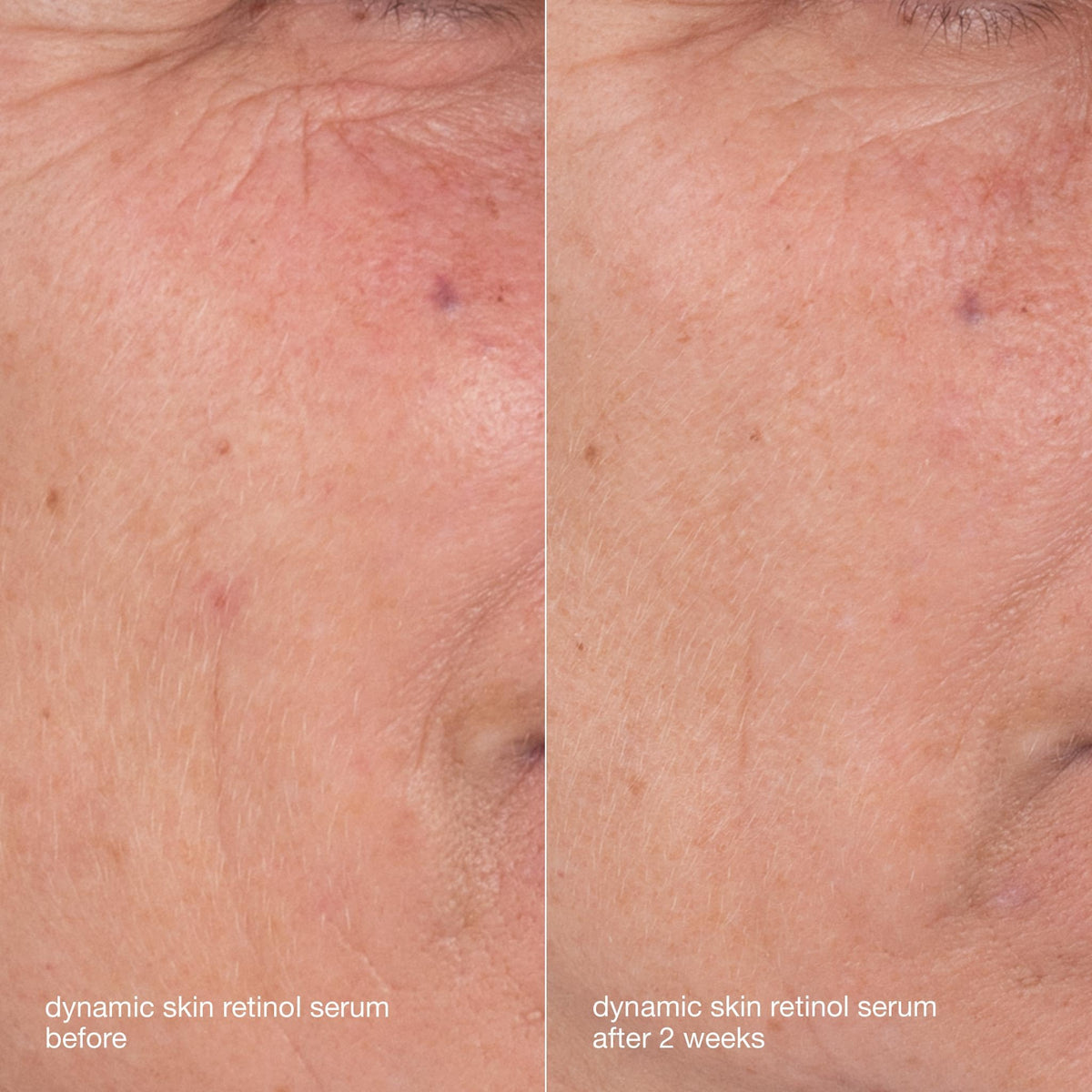 Dermalogica Skin Aging Solutions Kit Anti Aging Skincare Set - Premium Selection Official Imagery - 8
