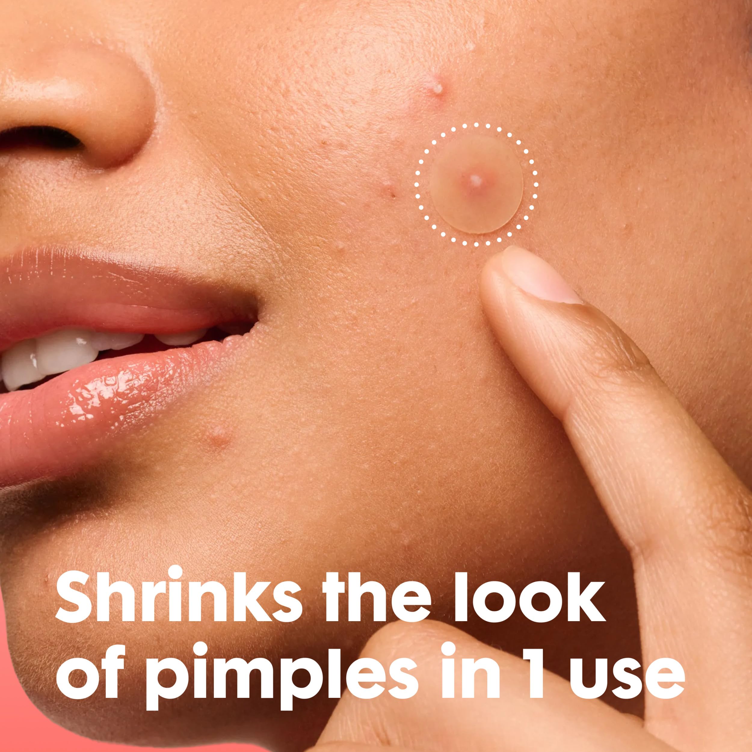 Mighty Patch Hero Cosmetics Original Nighttime Acne Pimple - Mighty Patch Official Imagery - 3