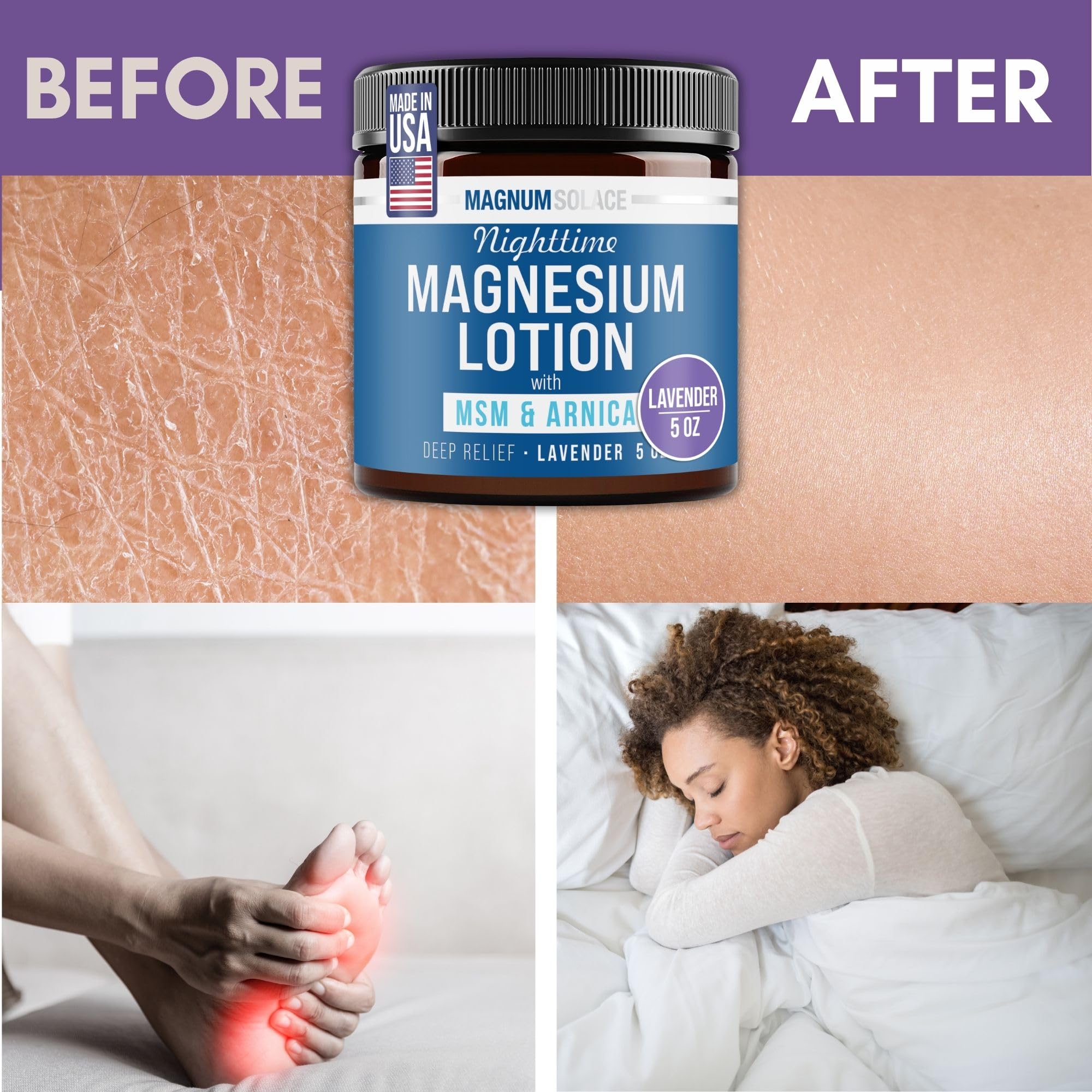 Magnum Solace Nighttime Magnesium Lotion with MSM & Arnica – Highly Concentrated Magnesium for Muscles & Joints – Apply to Legs or Feet Before Bed – Skin-Friendly