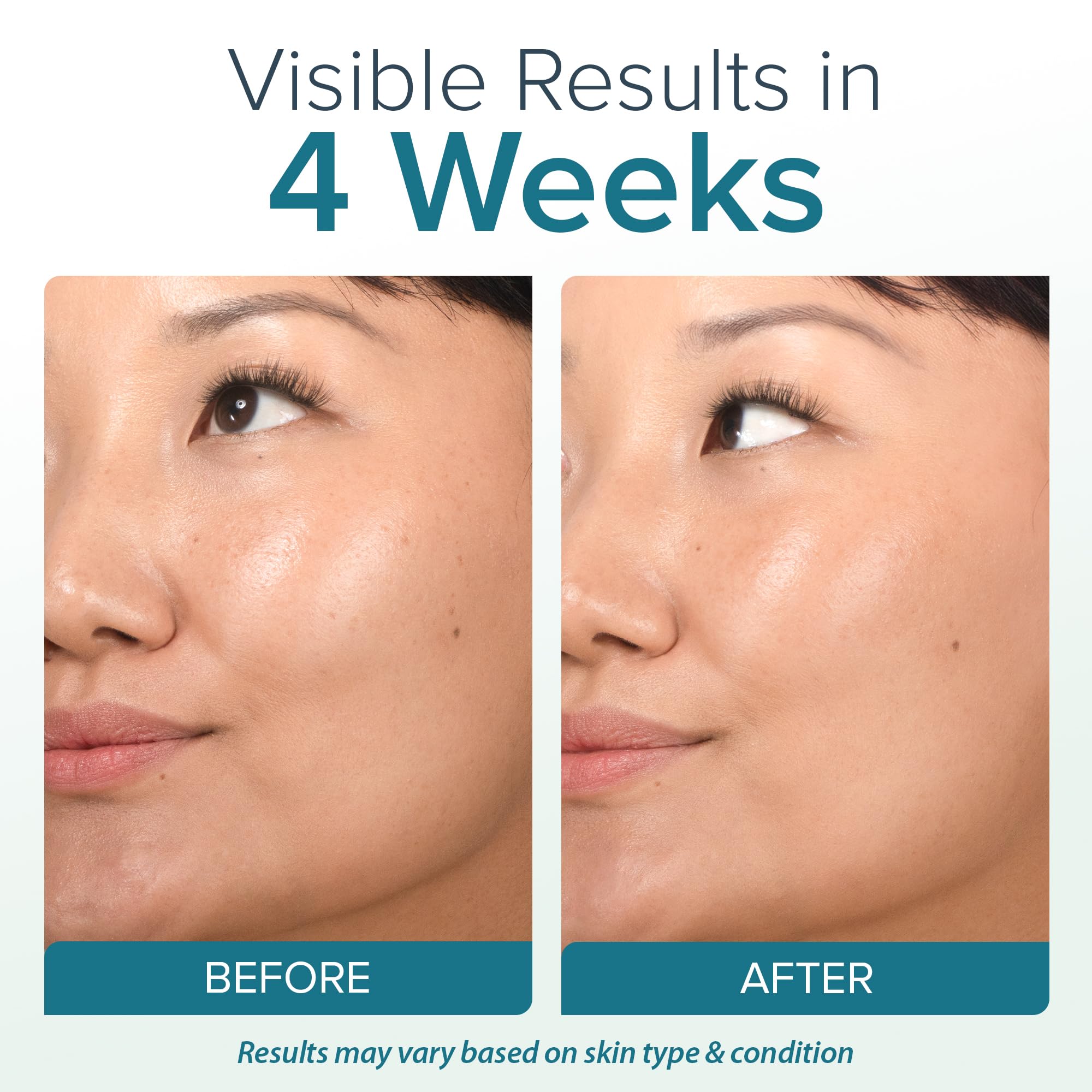 Ebanel Retinol Cream for Face 3 5Oz with Collagen Peptide - Ebanel Official Imagery - 6