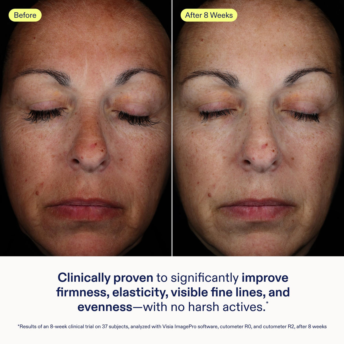 Skinfix Exo Ectoin Intensive Repair Baume - Skinfix Official Imagery - 4