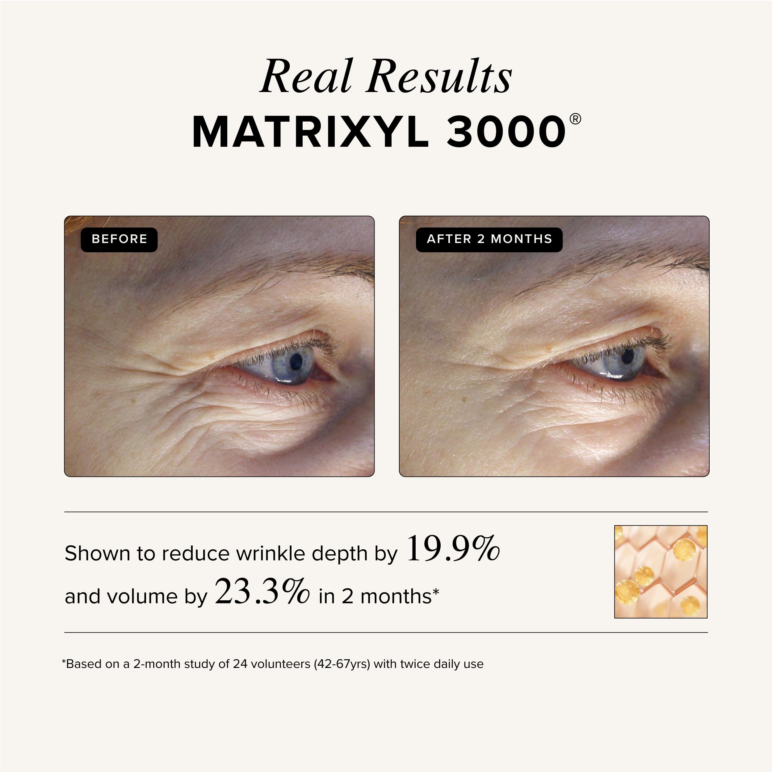 Asterwood Triple Repair Peptide Serum, Matrixyl 3000, Argireline & Vit. C - Asterwood Official Product View 6