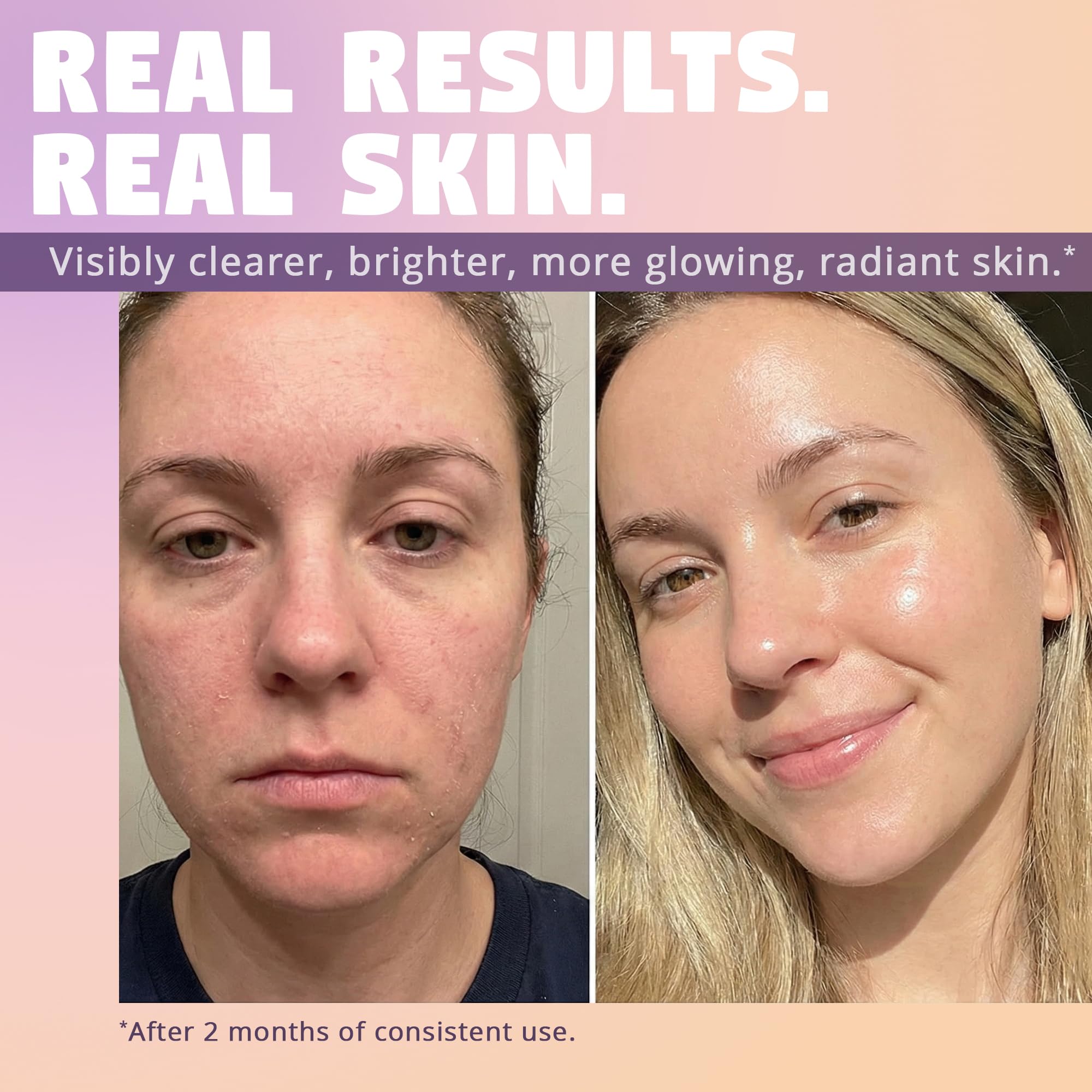Clinically Advanced Korean Snail Mucin Serum - Zen Dew