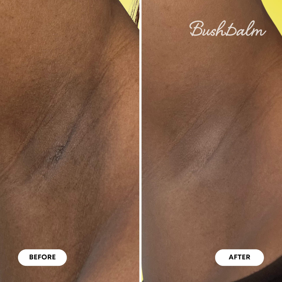 Bushbalm Dark Spot Exfoliating Body Scrub - Bushbalm Official Imagery - 6