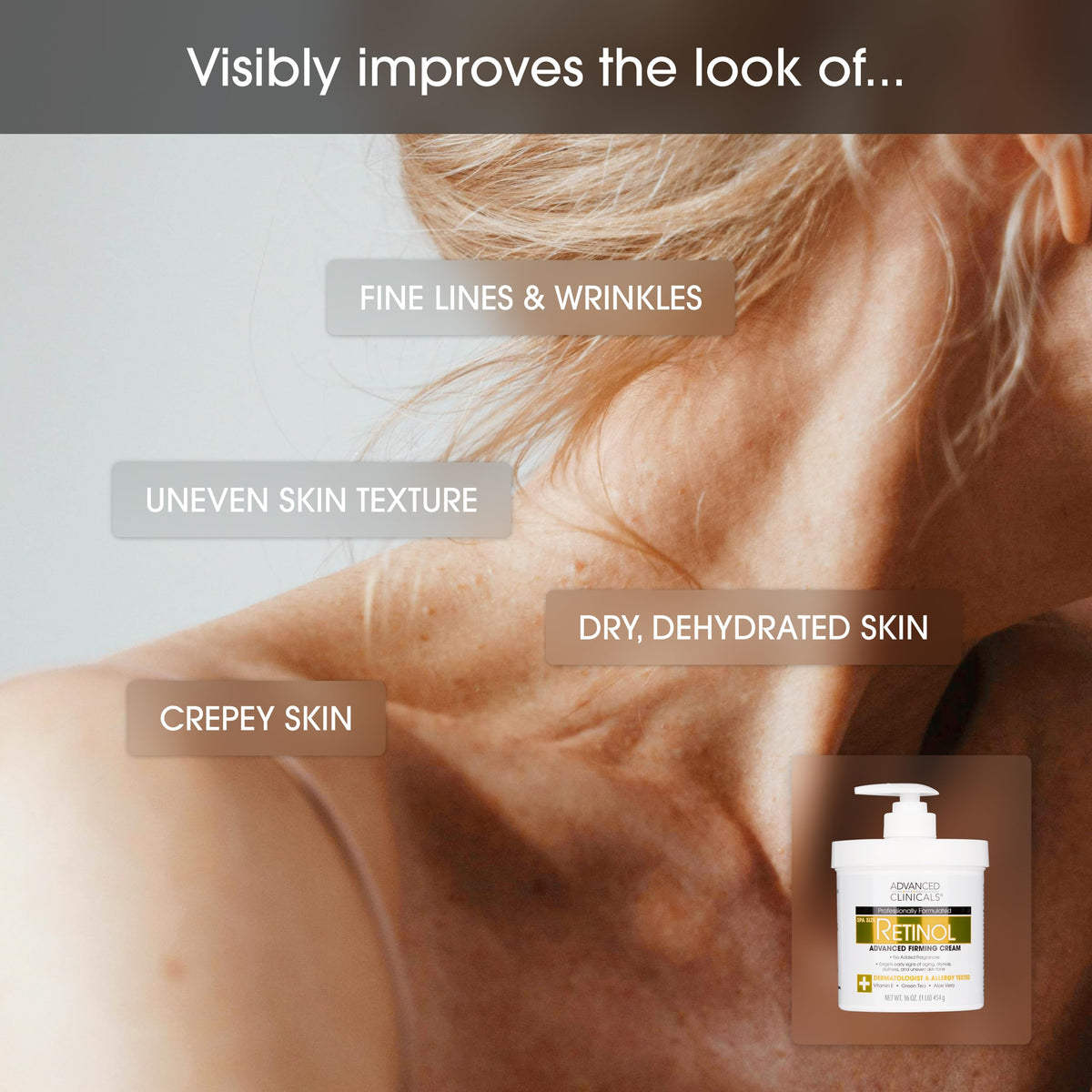 Advanced Clinicals Retinol Cream Collagen Peptides Body - Advanced Clinicals Official Imagery - 6