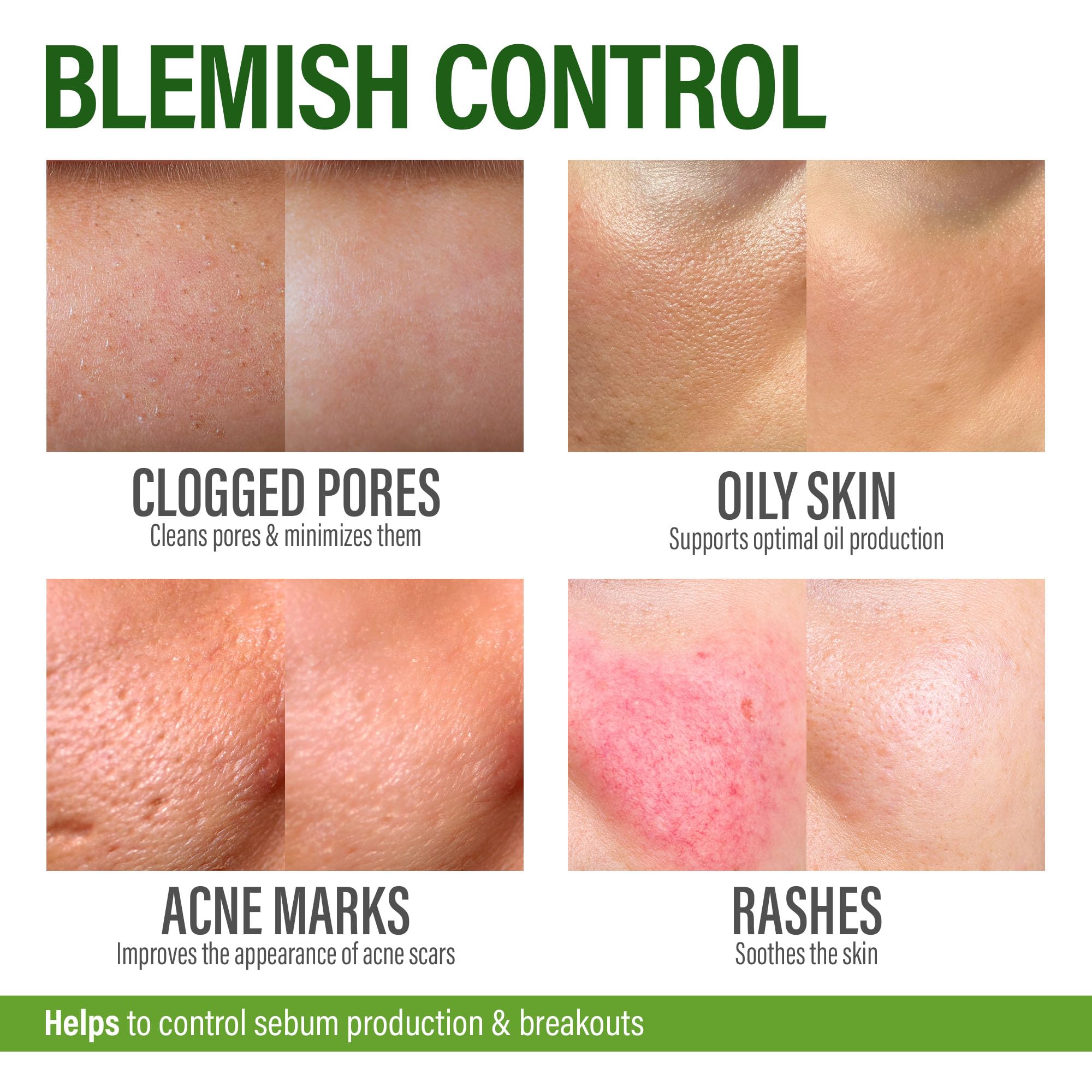 Salicylic Acid Face Cream - GRAMRIGHT Official Imagery - 5