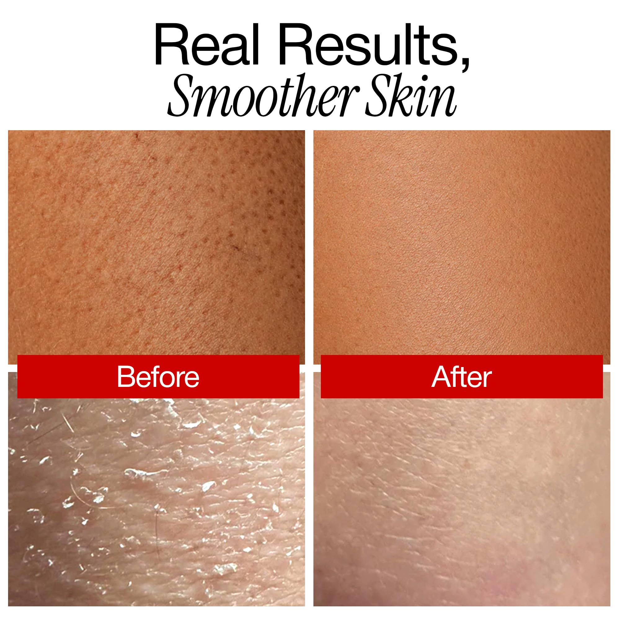 ABI AME Body Exfoliator 30% AHA 2% BHA Pre - Shower Exfoliating Mask - ABI AME Official Product View 7