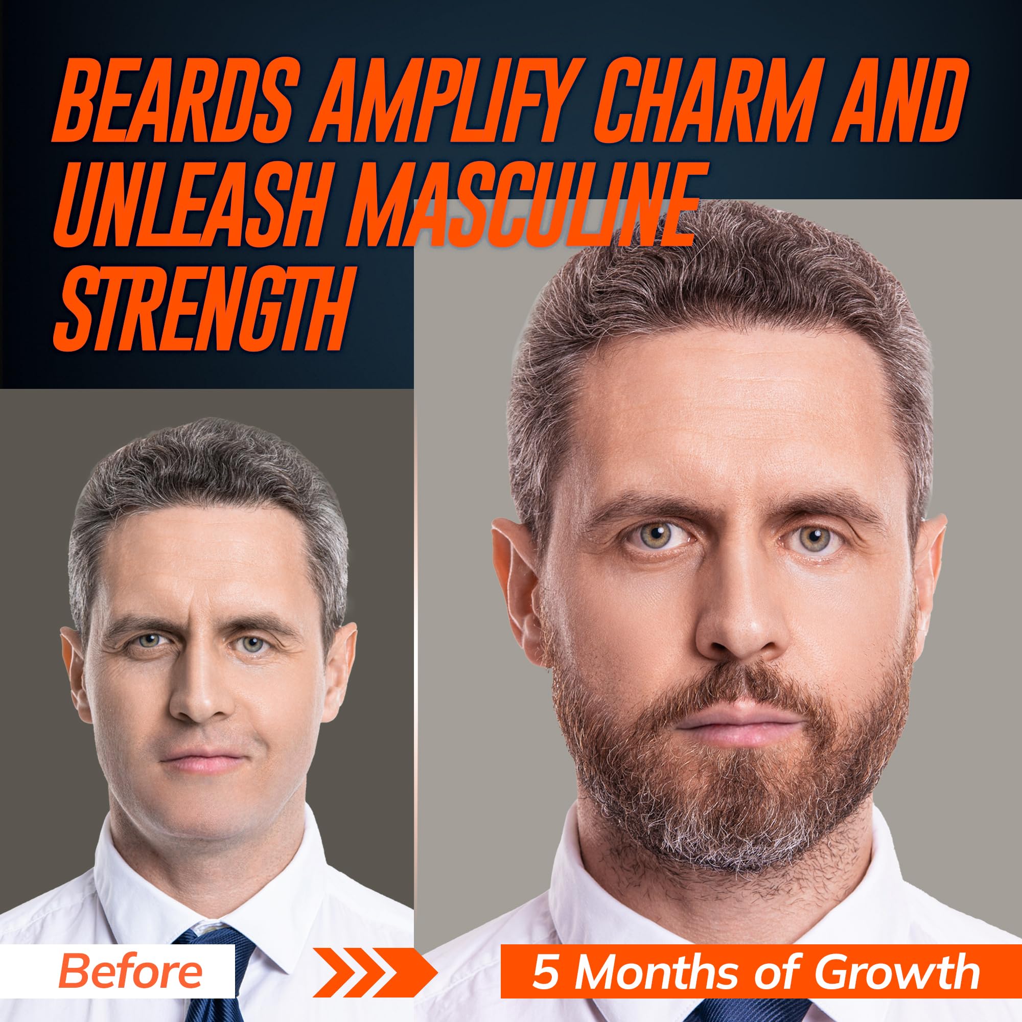 5 Minoxidil Beard Growth Serum for Men 2 Pack Minoxidil Hair - RootStim Official Imagery - 4