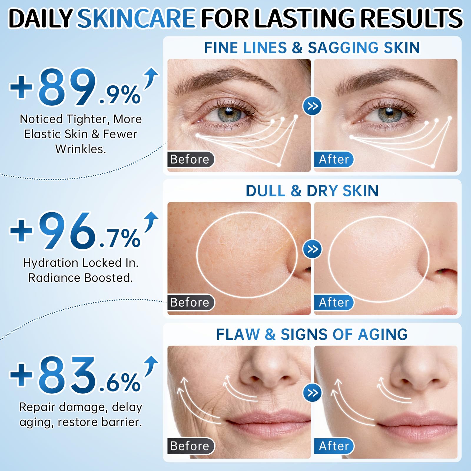 Collagen Skincare Set for Women – 7Pcs Face Care Kit with - BECHOICEN