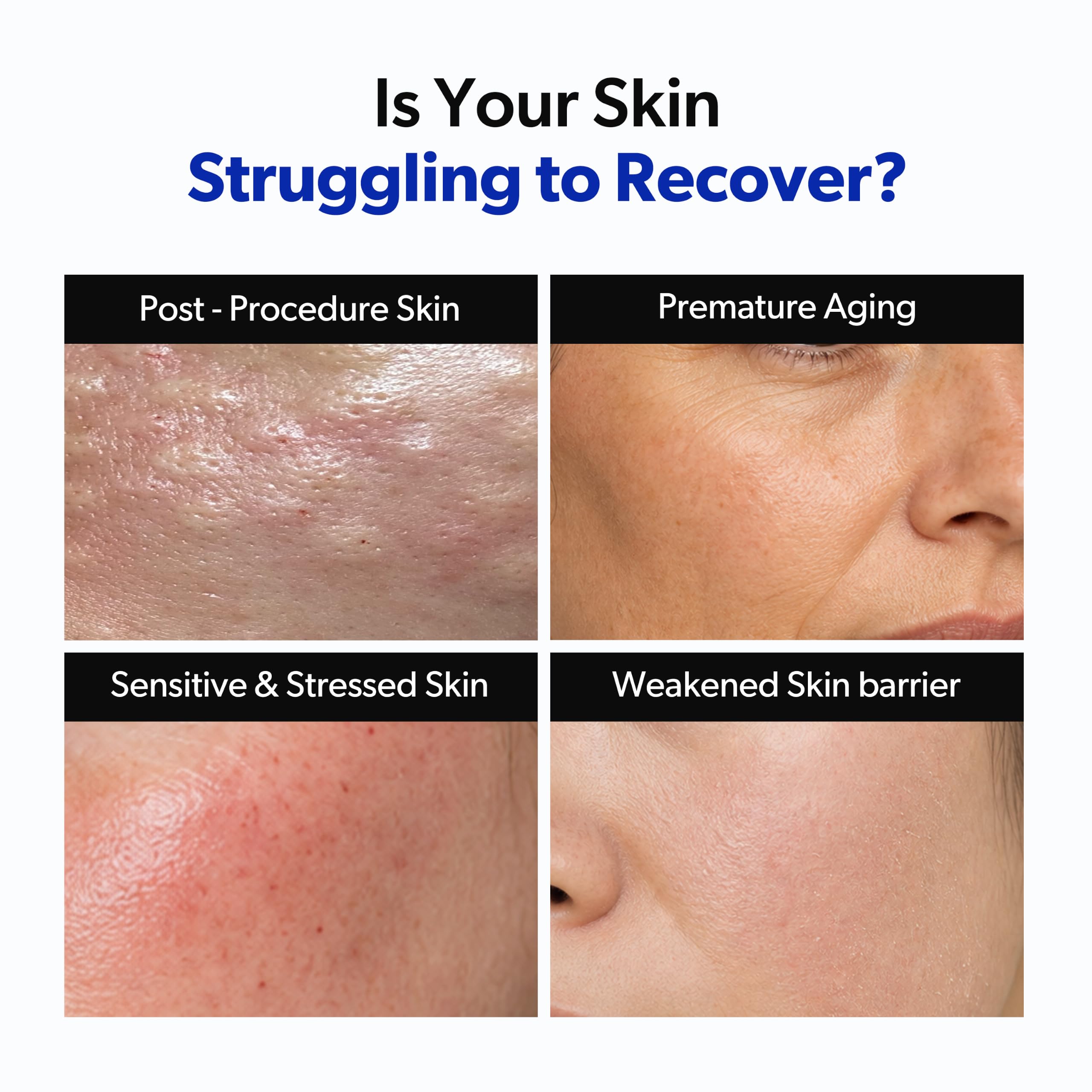 Pepfactor 23% Growth Factor Barrier Recovery Serum - bnv biolab
