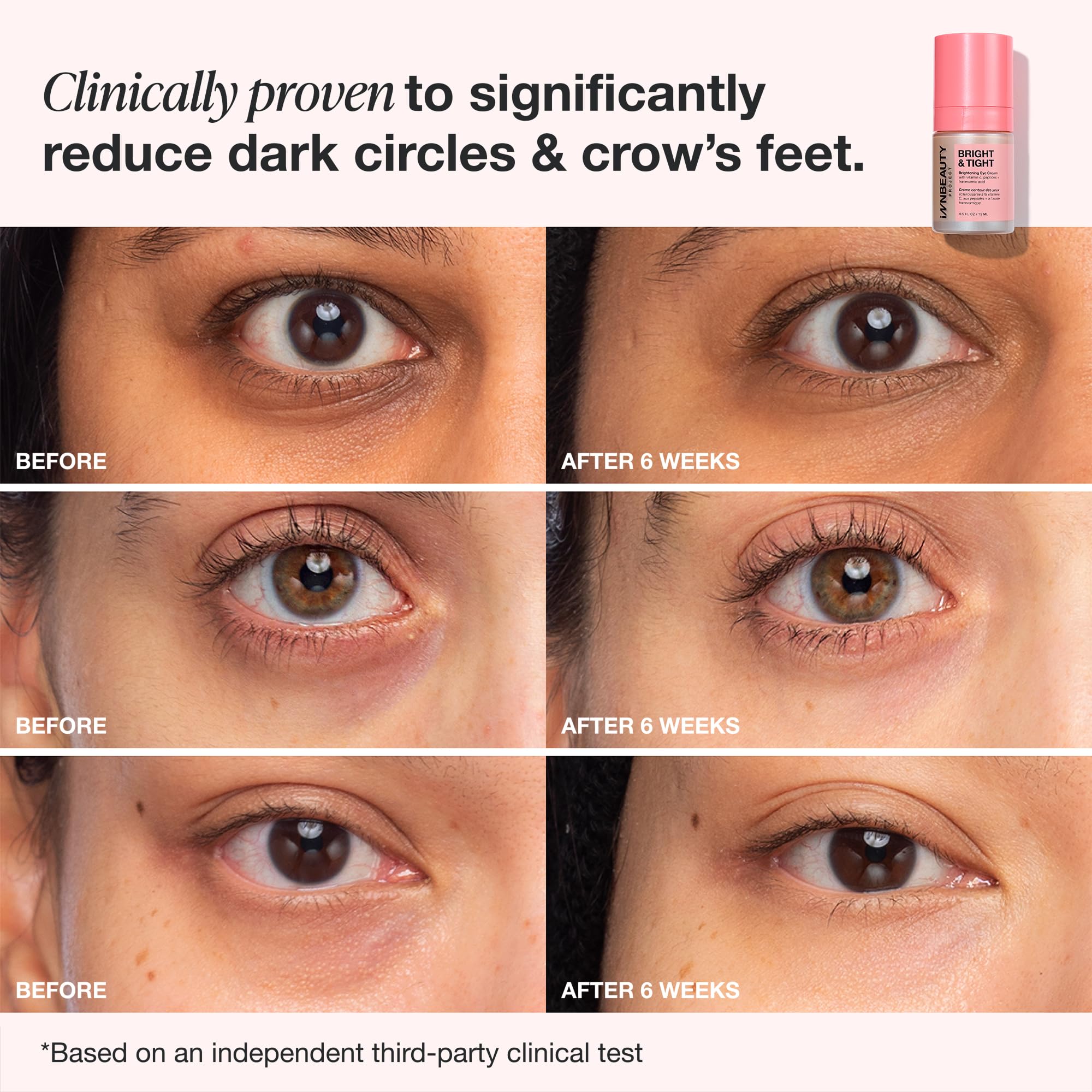 Innbeauty Project Bright Tight Refillable Eye Cream 0 5 oz - Innbeauty Project Official Imagery - 8