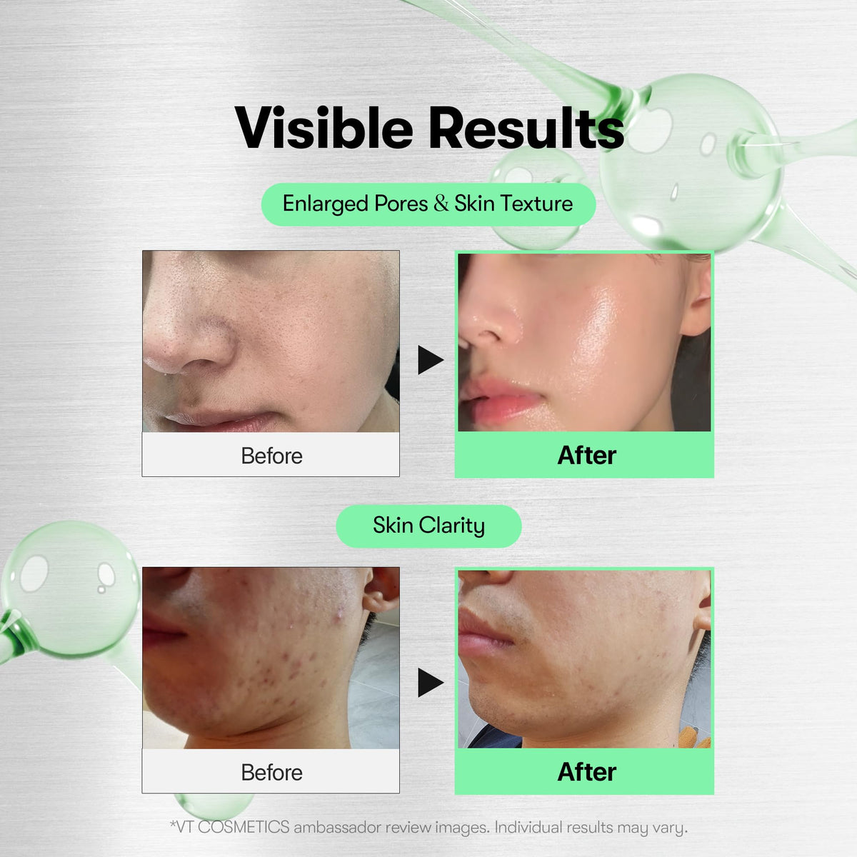 VT COSMETICS CICA Reedle Shot 700 Spicule Microneedling - VT COSMETICS Official Imagery - 4