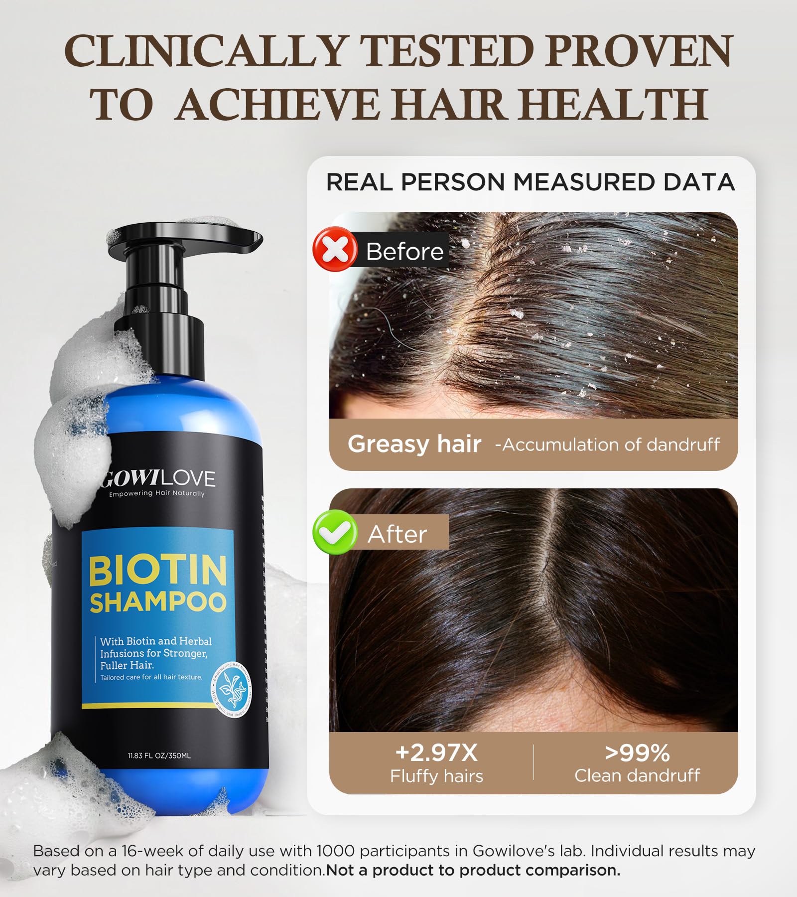 GOWILOVE Biotin Shampoo for 3X Faster Hair Growth, 80% Less Hair Loss w - Thuja - GOWILOVE Official Product View 5